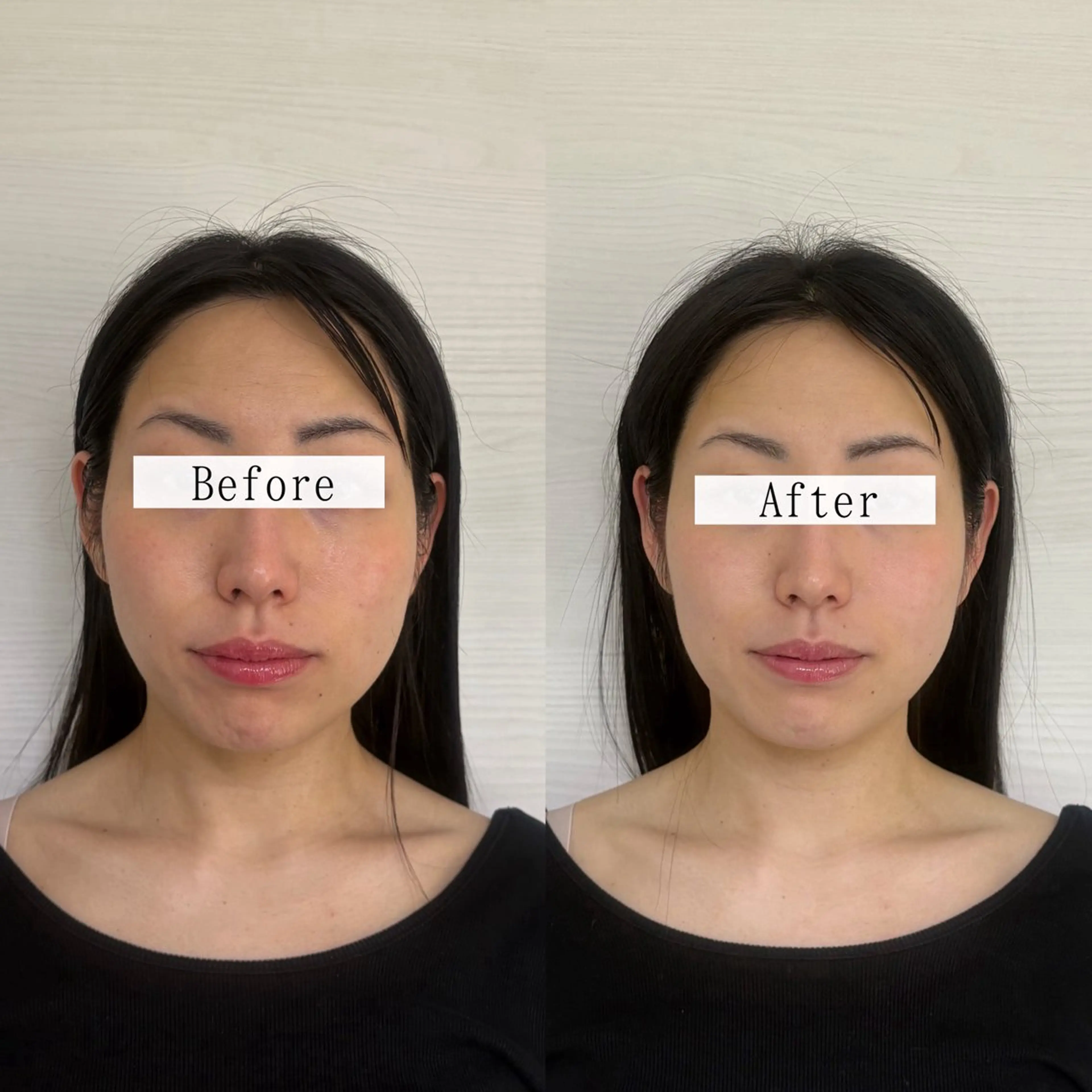 欲張りメニュー【ドライヘッドスパ+小顔矯正】じっくりほぐして流す70分の写真