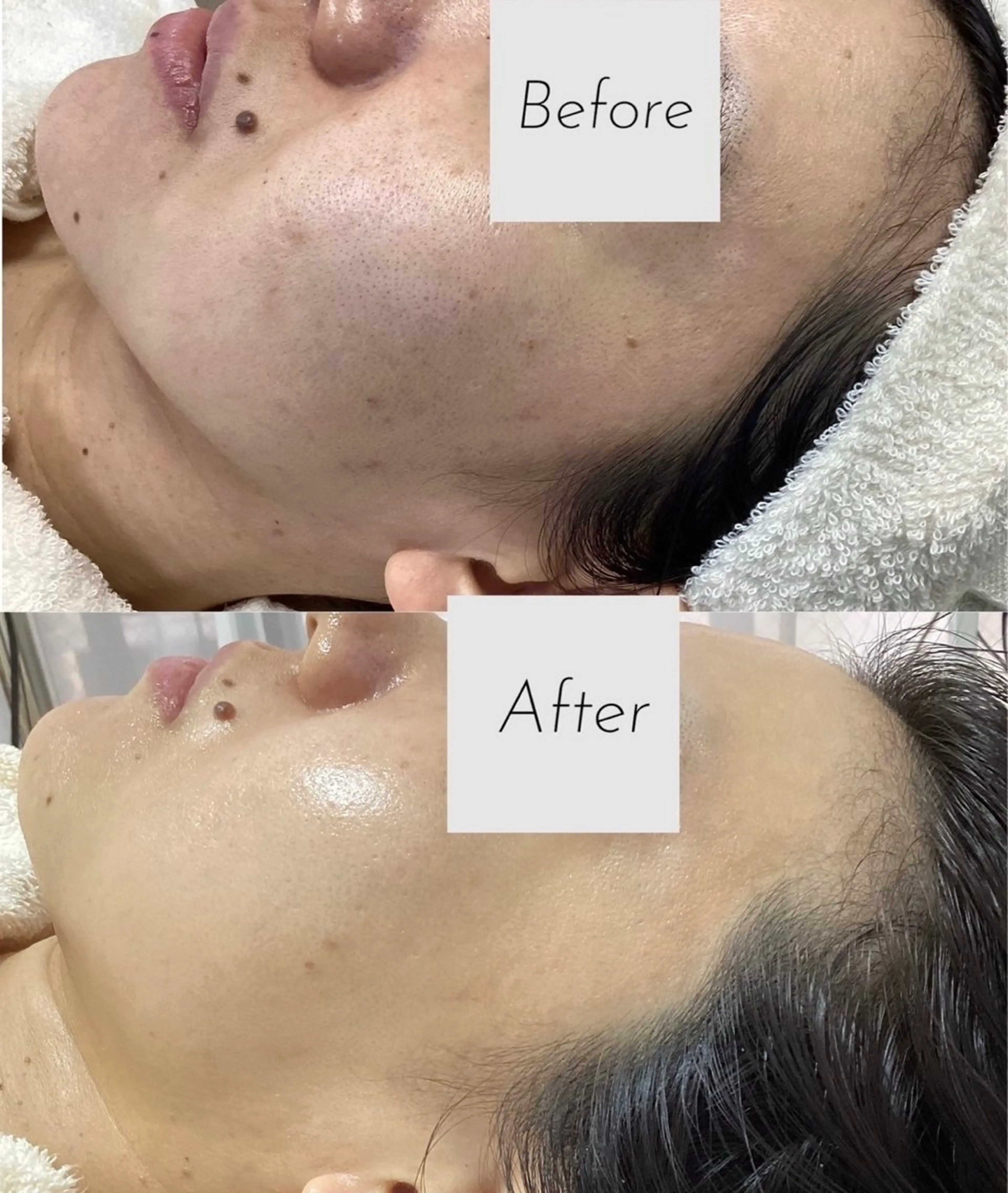 エステ 都度払い 肌質改善専門サロンのエステ・リラクイメージ