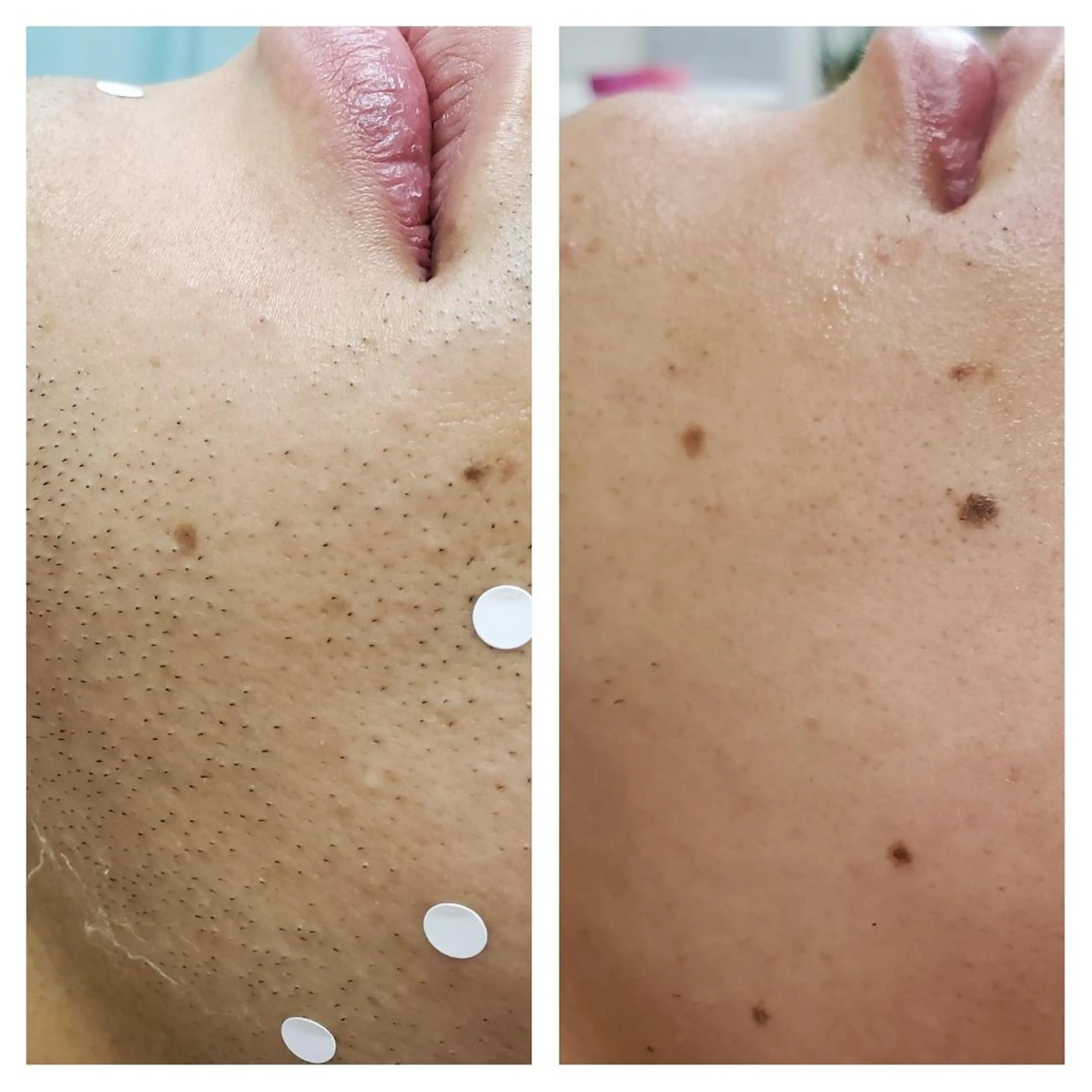 メンズ 阿部 恵子のエステ・リラクイメージ