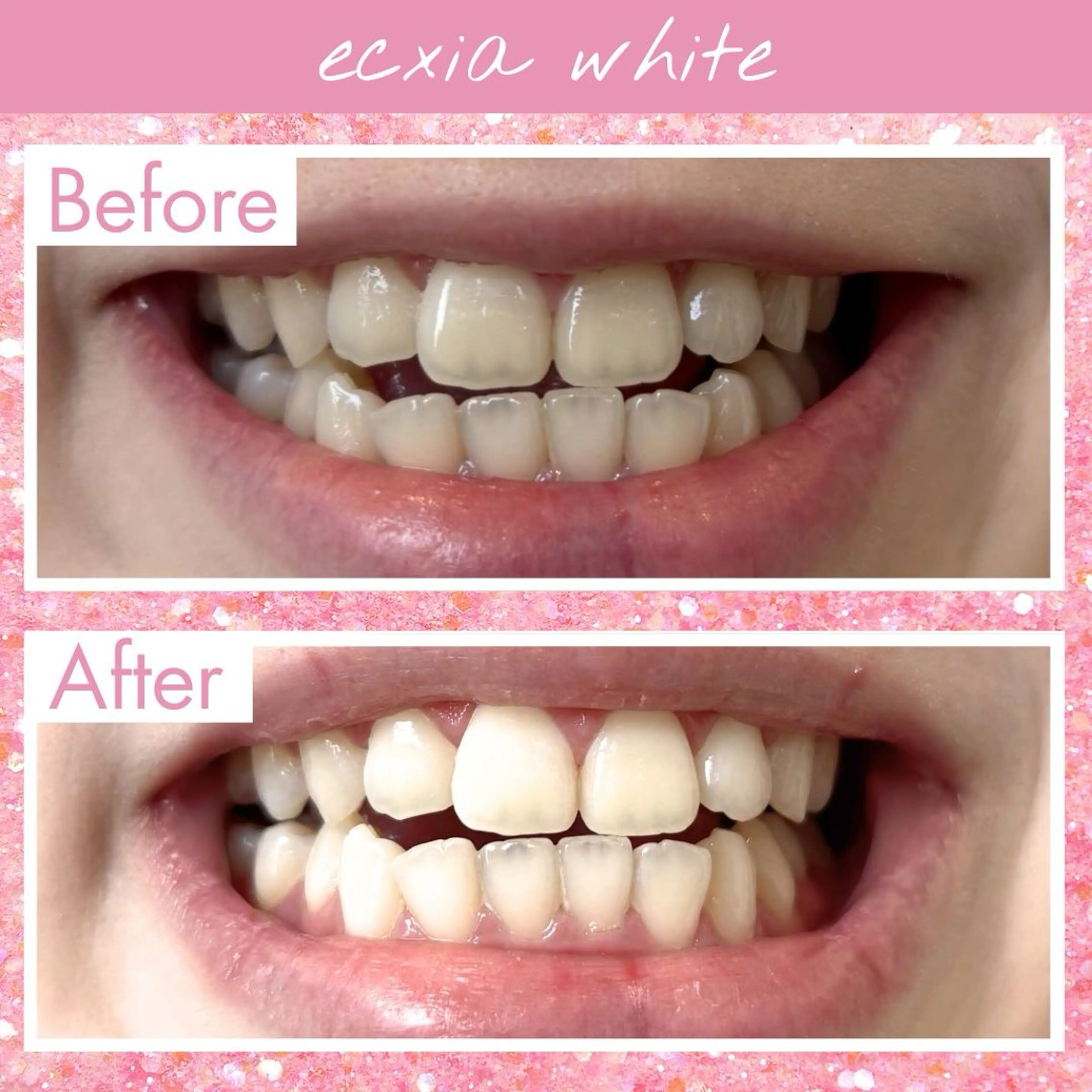 その他 エクシアホワイト福岡六本松所属・エクシア福岡六本松 喜多のその他イメージ