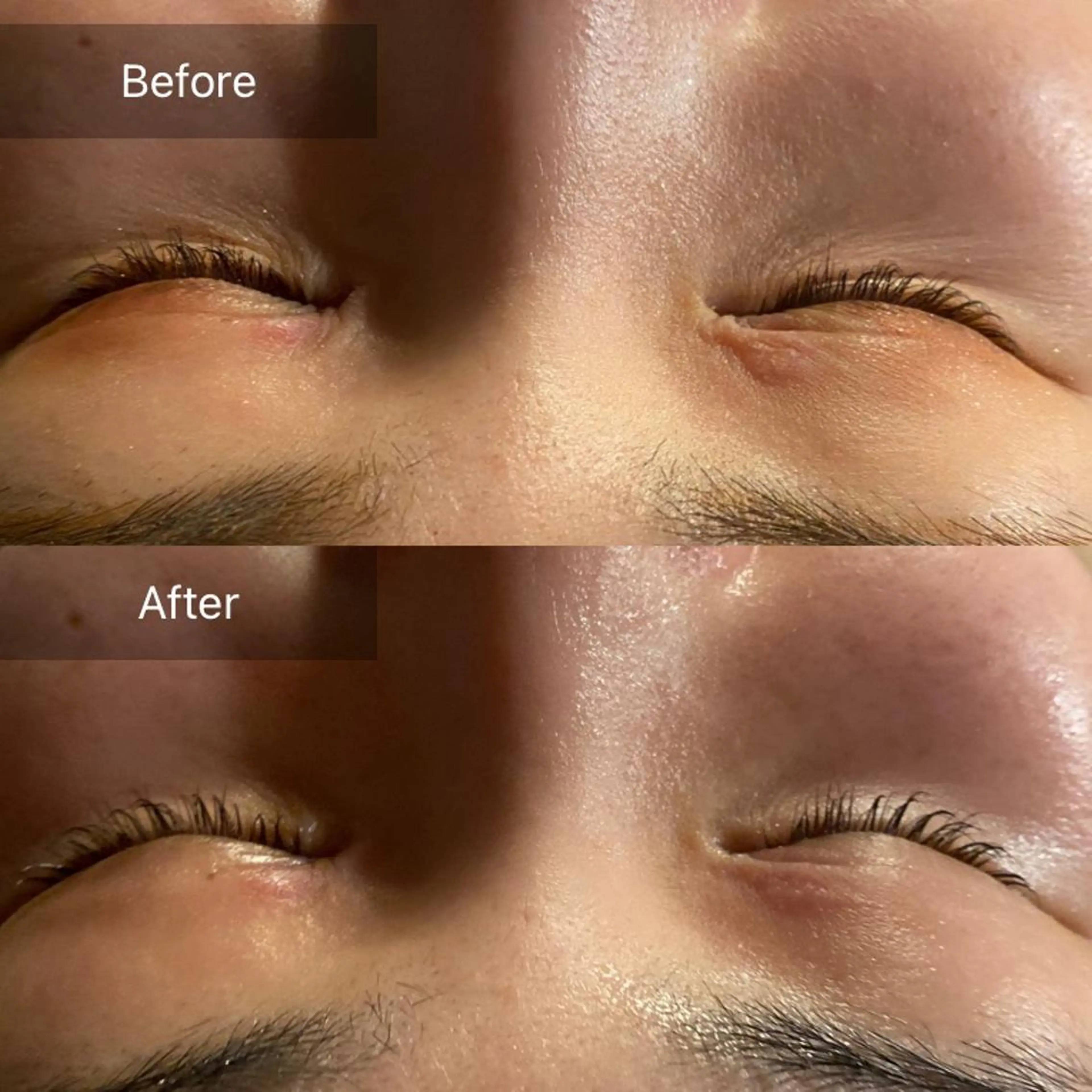 Mandarin Orange所属・毛穴から始める肌メン テマンダリンオレンジのエステ・リラクイメージ