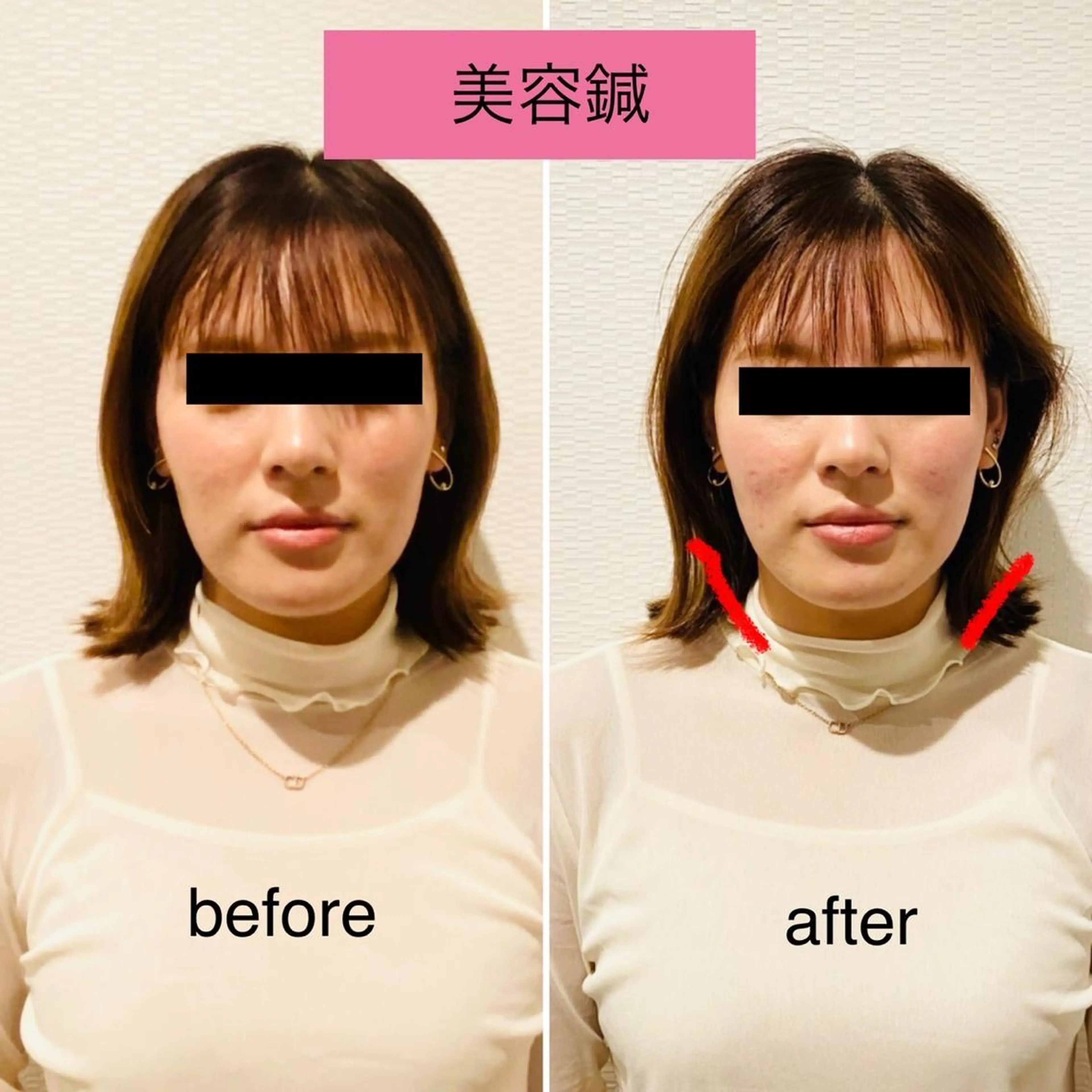 エステ チキバン美容鍼灸整体 サロン心斎橋店のエステ・リラクイメージ