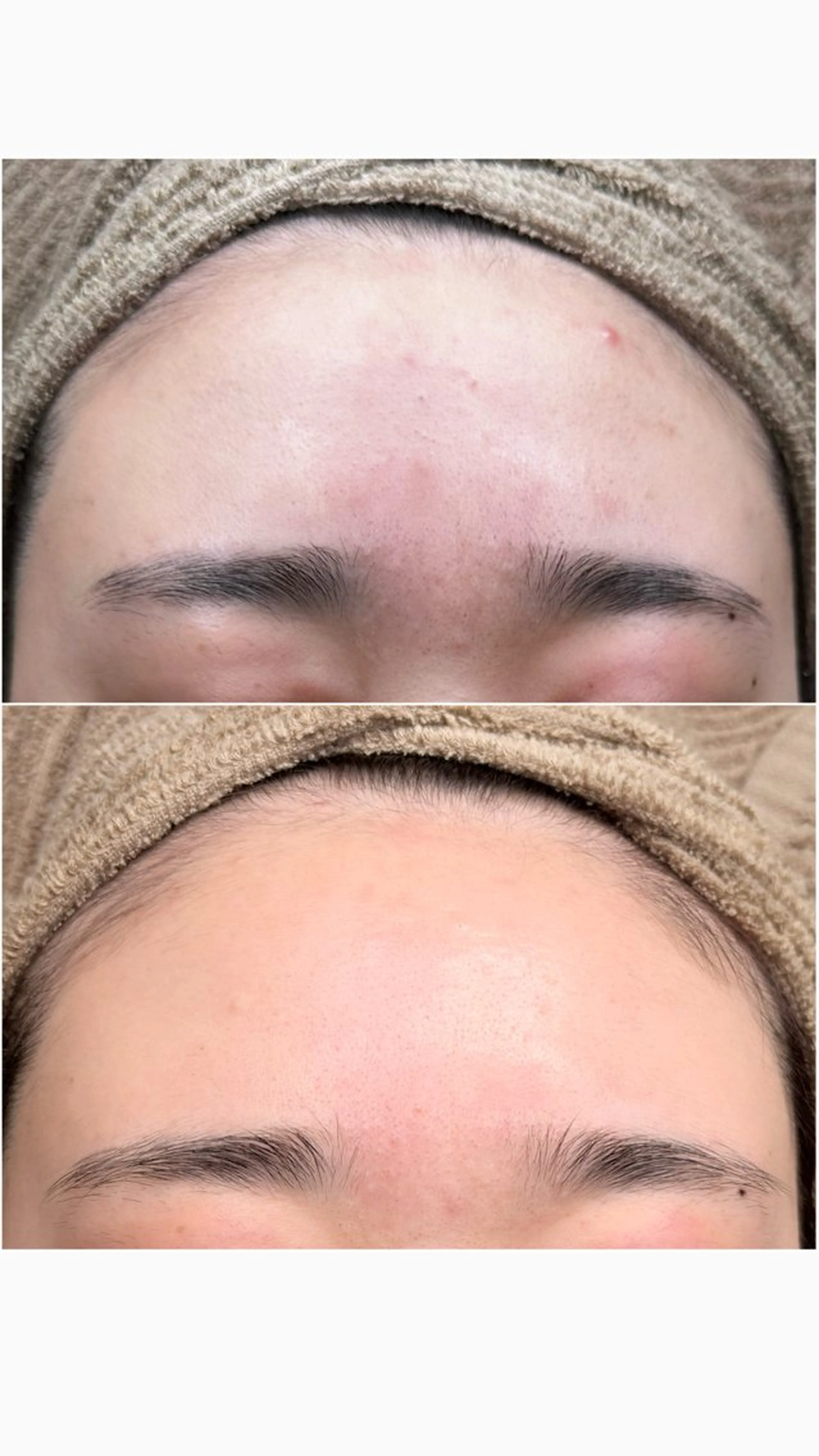 最新プラズマ⚡️フェイシャルの写真