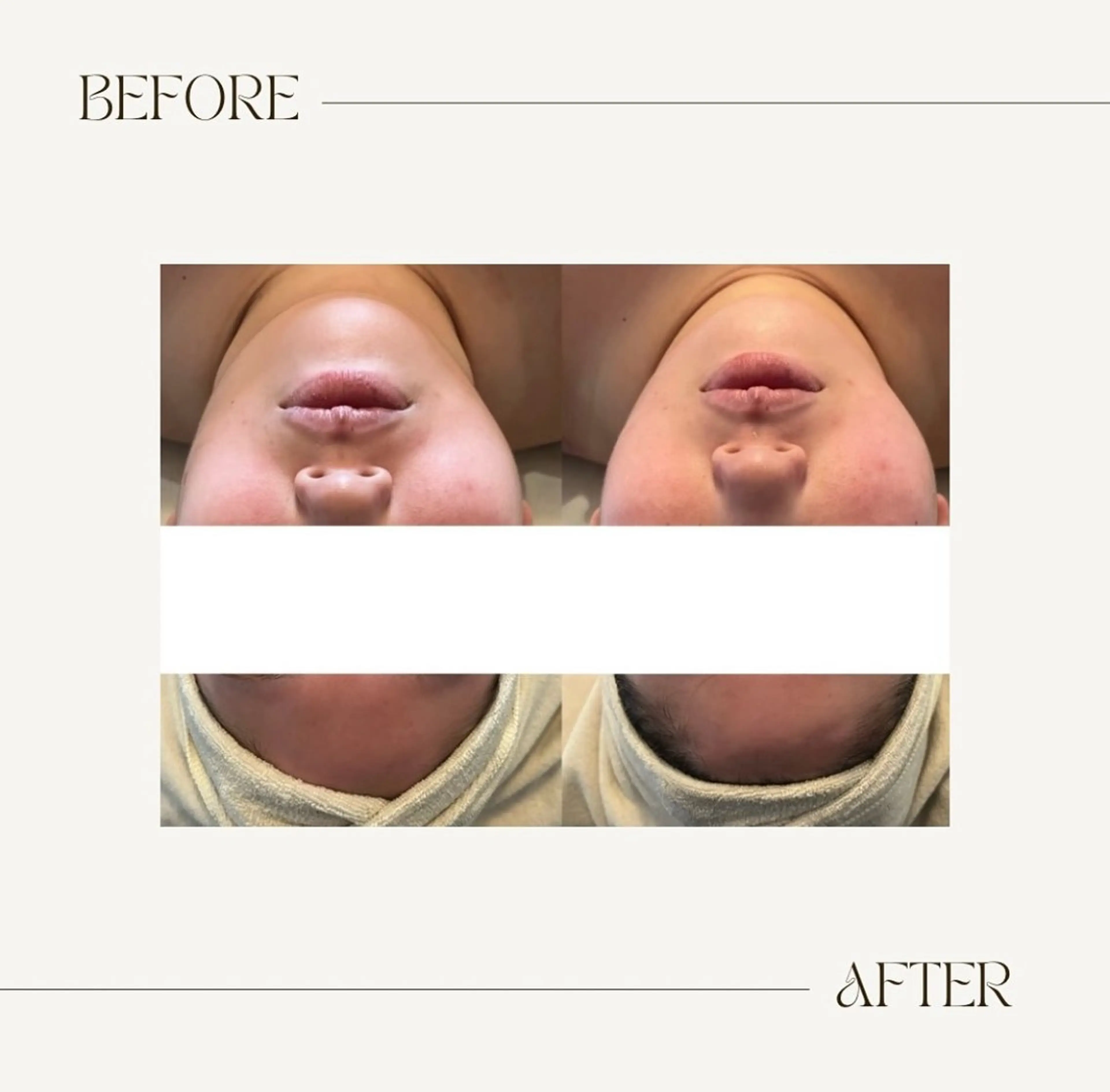 エステ salon Soie所属・salon Soieのエステ・リラクイメージ