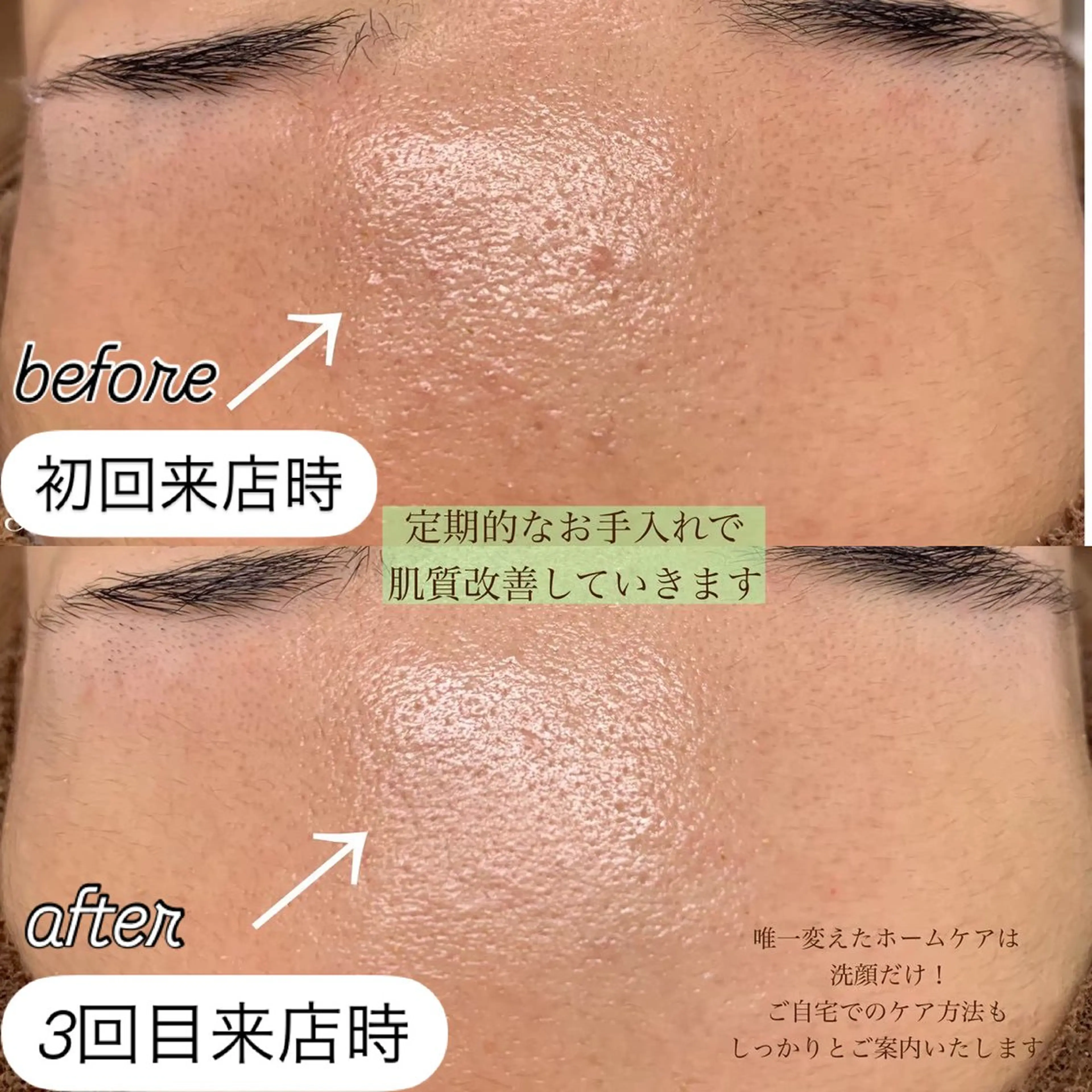 one day所属・肌質改善ハーブサロン ALA原宿のエステ・リラクイメージ