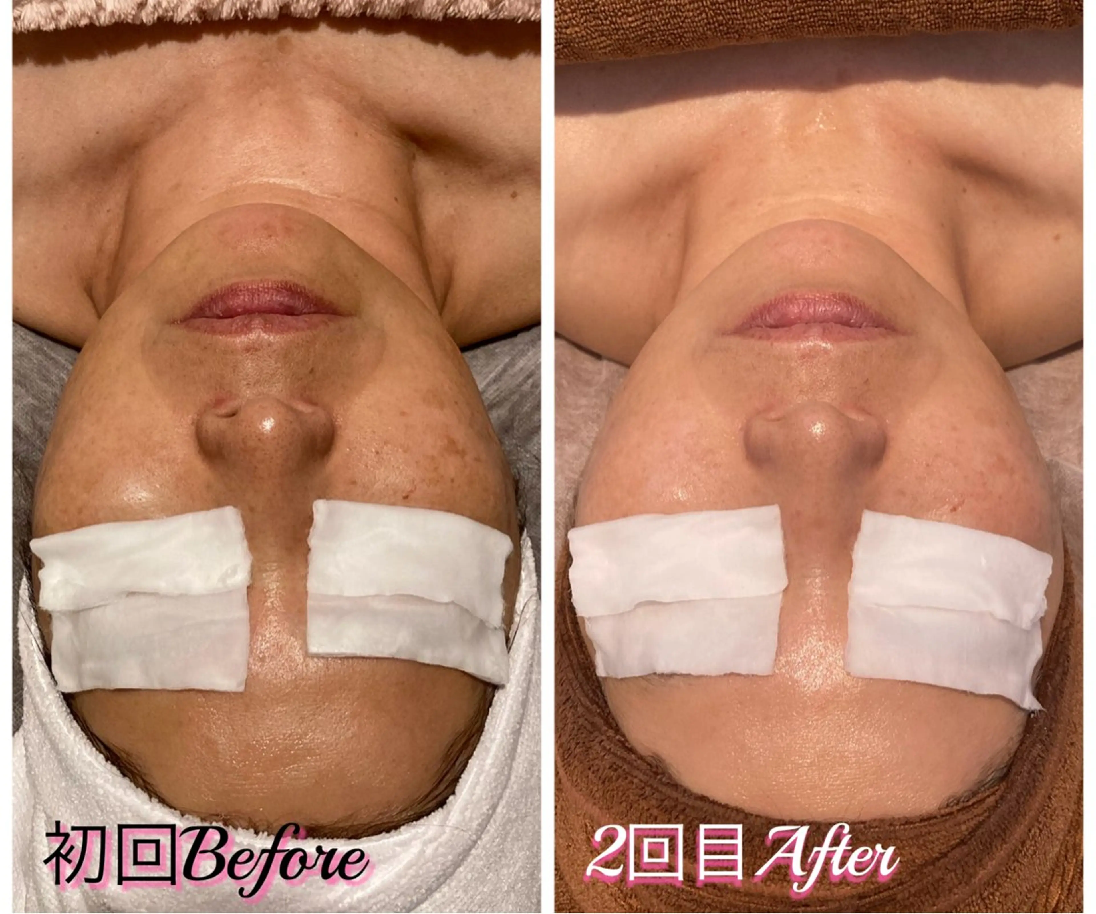 エステ SA KIのマツエク・マツパデザイン