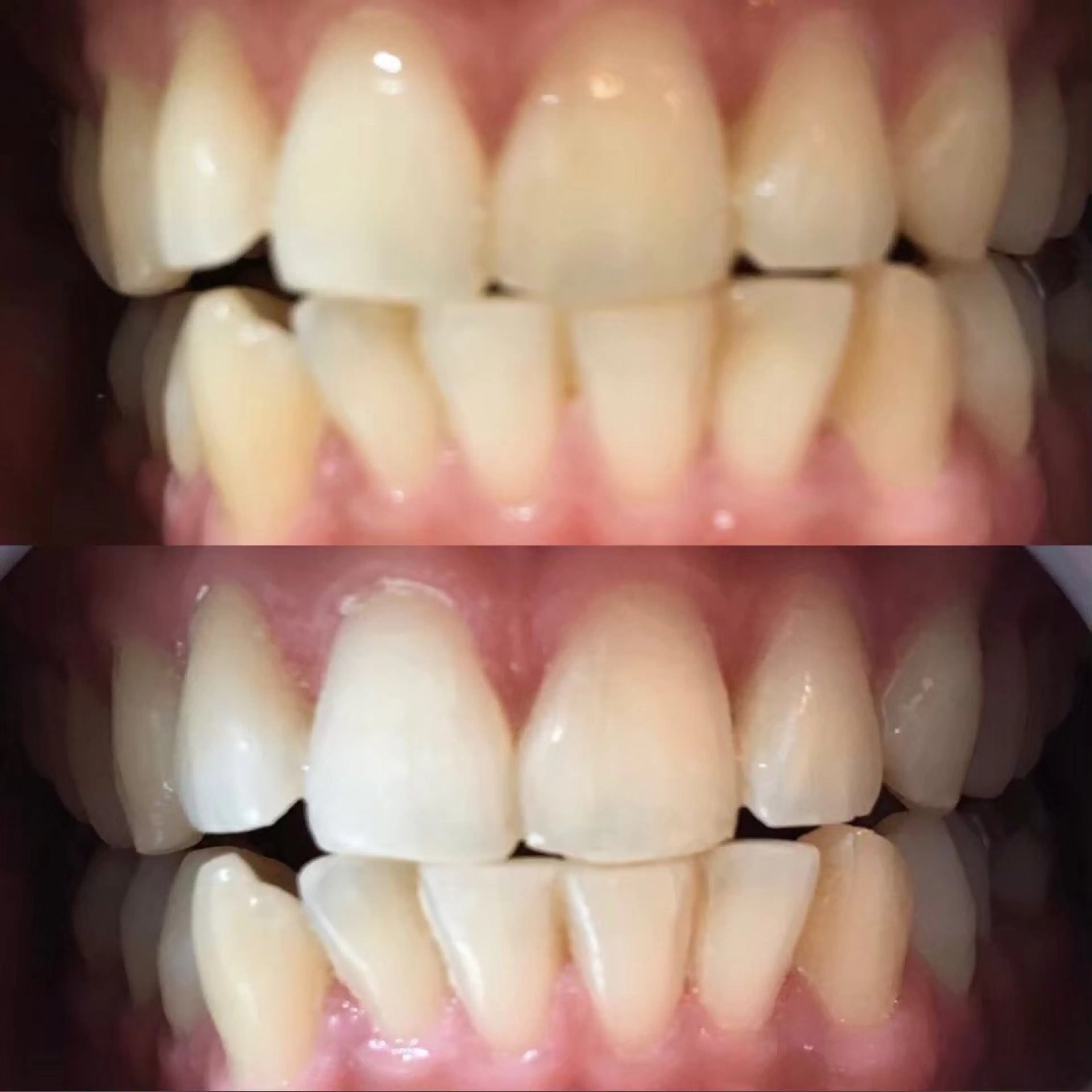 LBSホワイトニング上野店所属・LBSホワイトニング 🌐 上野店公式のエステ・リラクイメージ