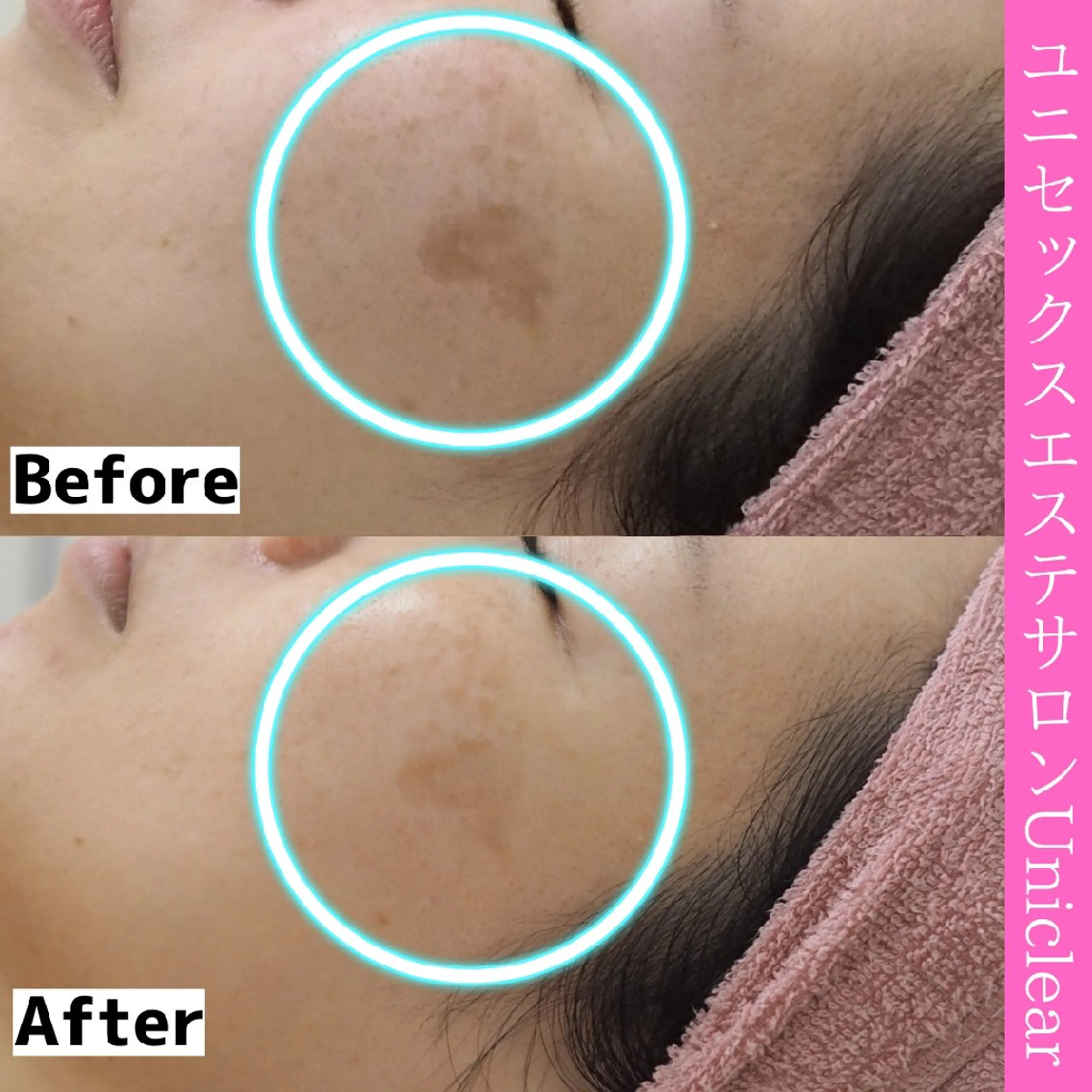 ユニセックスエステサロンUniclear所属・痩身&フェイシャル Uniclearのエステ・リラクイメージ