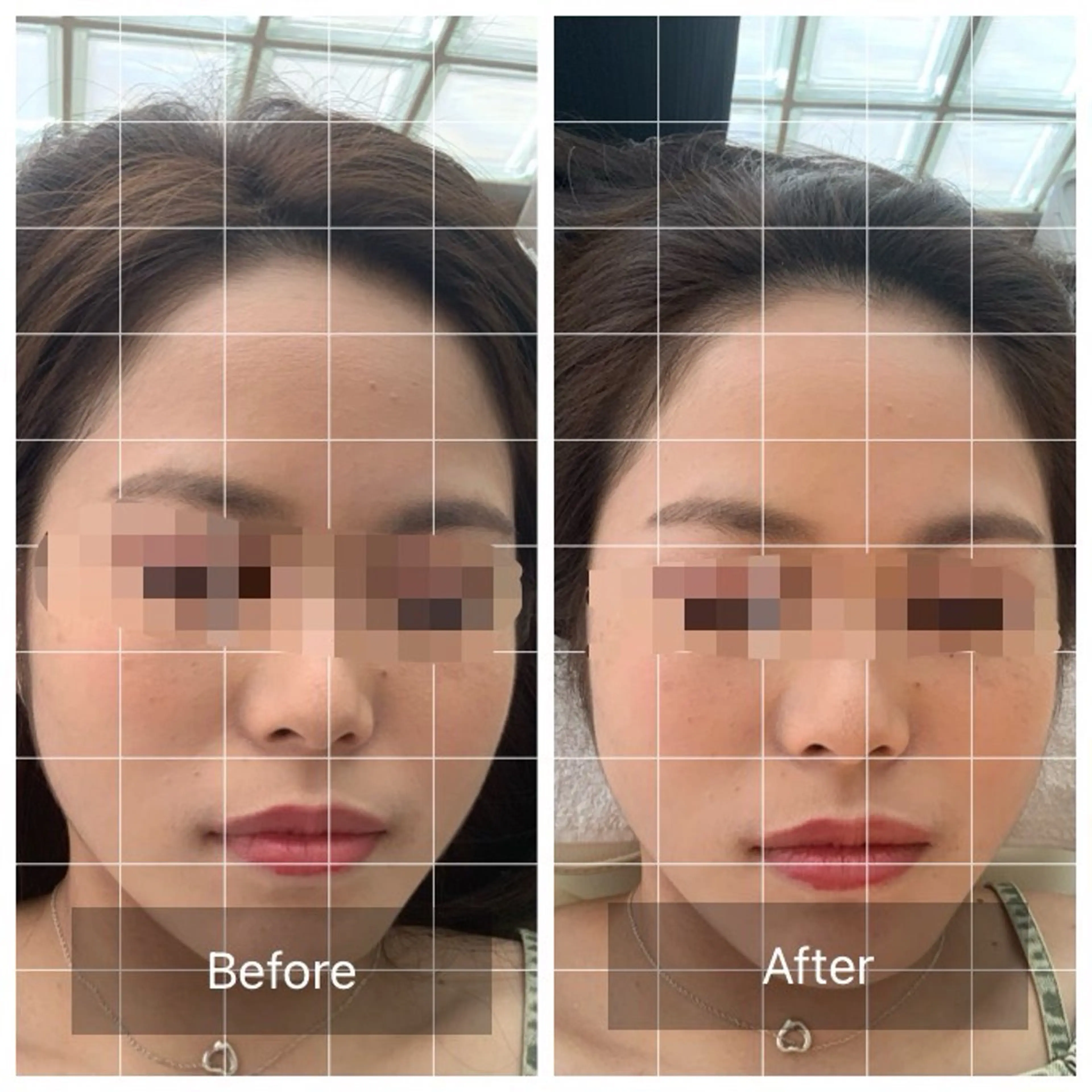エステ うめきた鍼灸院 SENSEのエステ・リラクイメージ