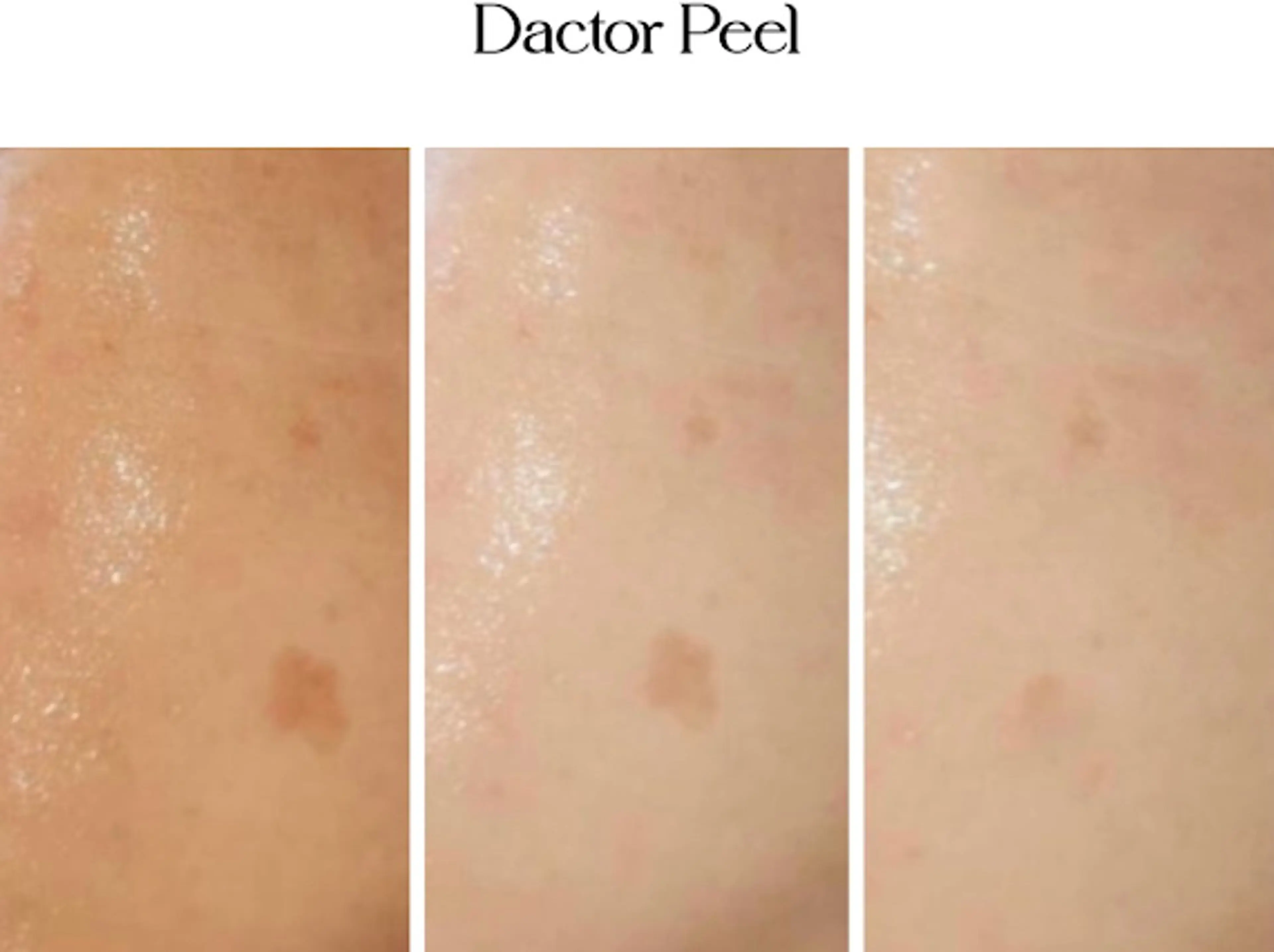 chouchou【シュシュ】所属・トータルボディケア chouchouのエステ・リラクイメージ