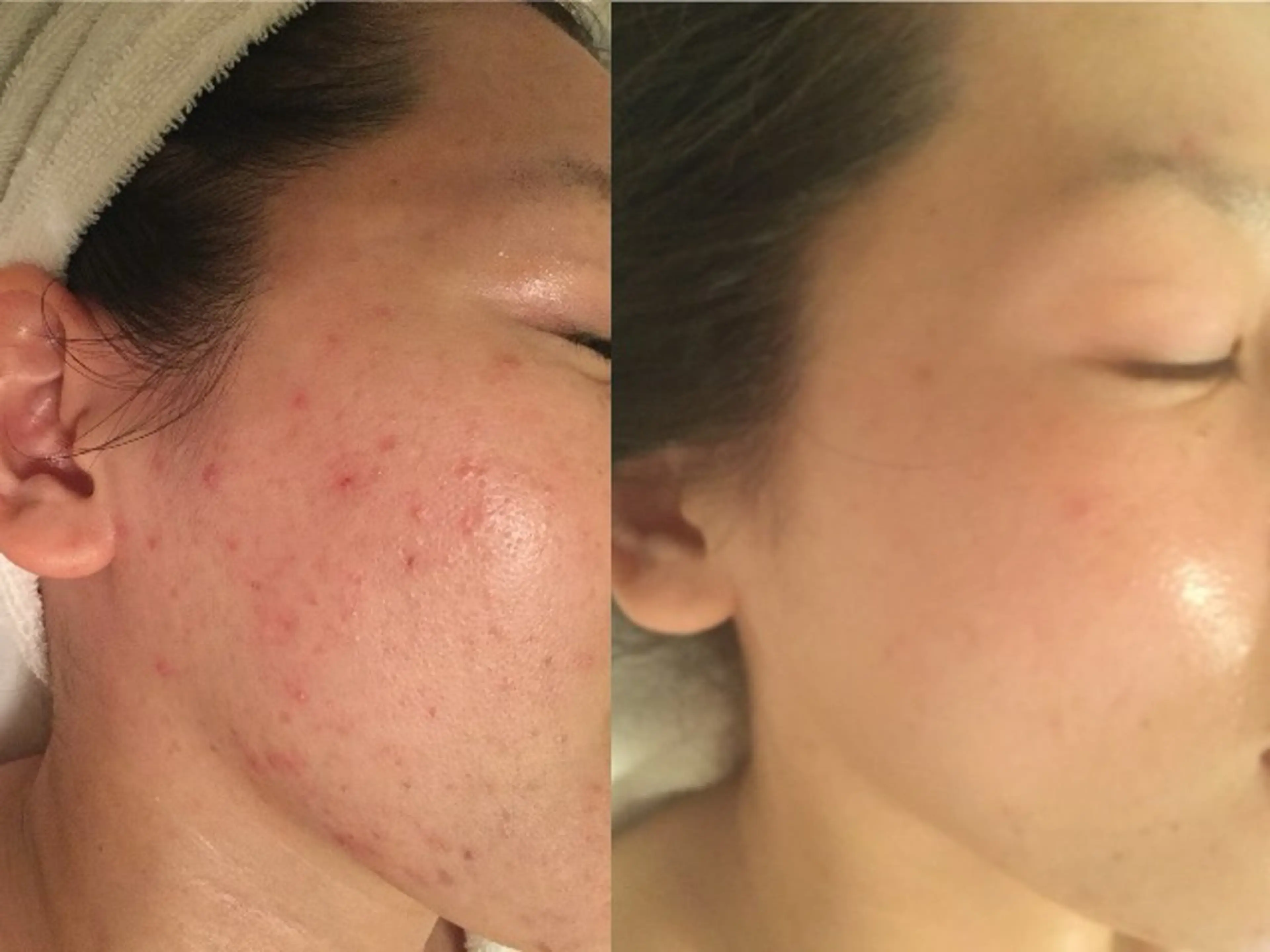 国際認定エステサロン ホワイトカメリアのエステ・リラクイメージ