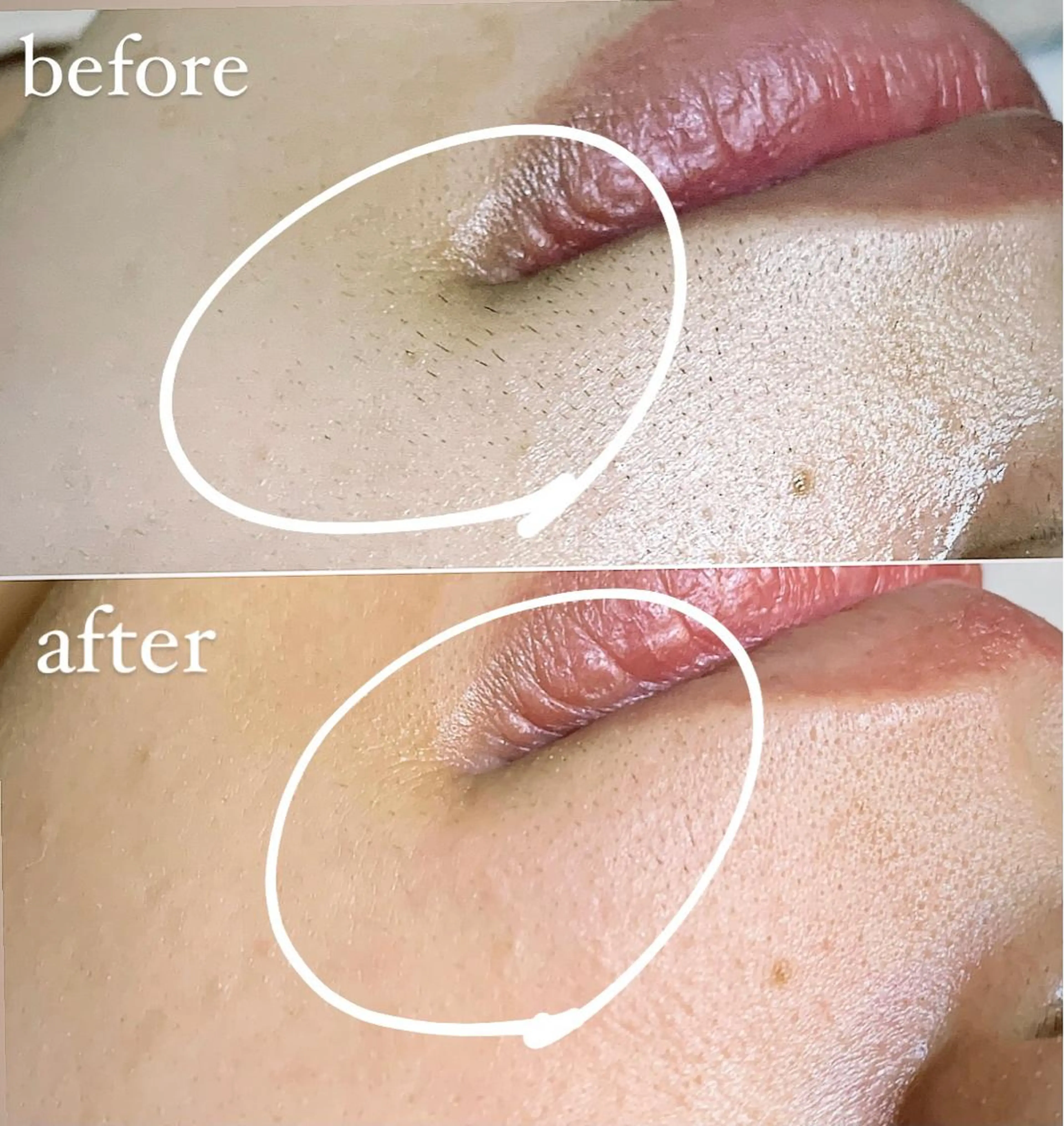 eyelash salon  kirari所属・岩間 優子のマツエク・マツパデザイン