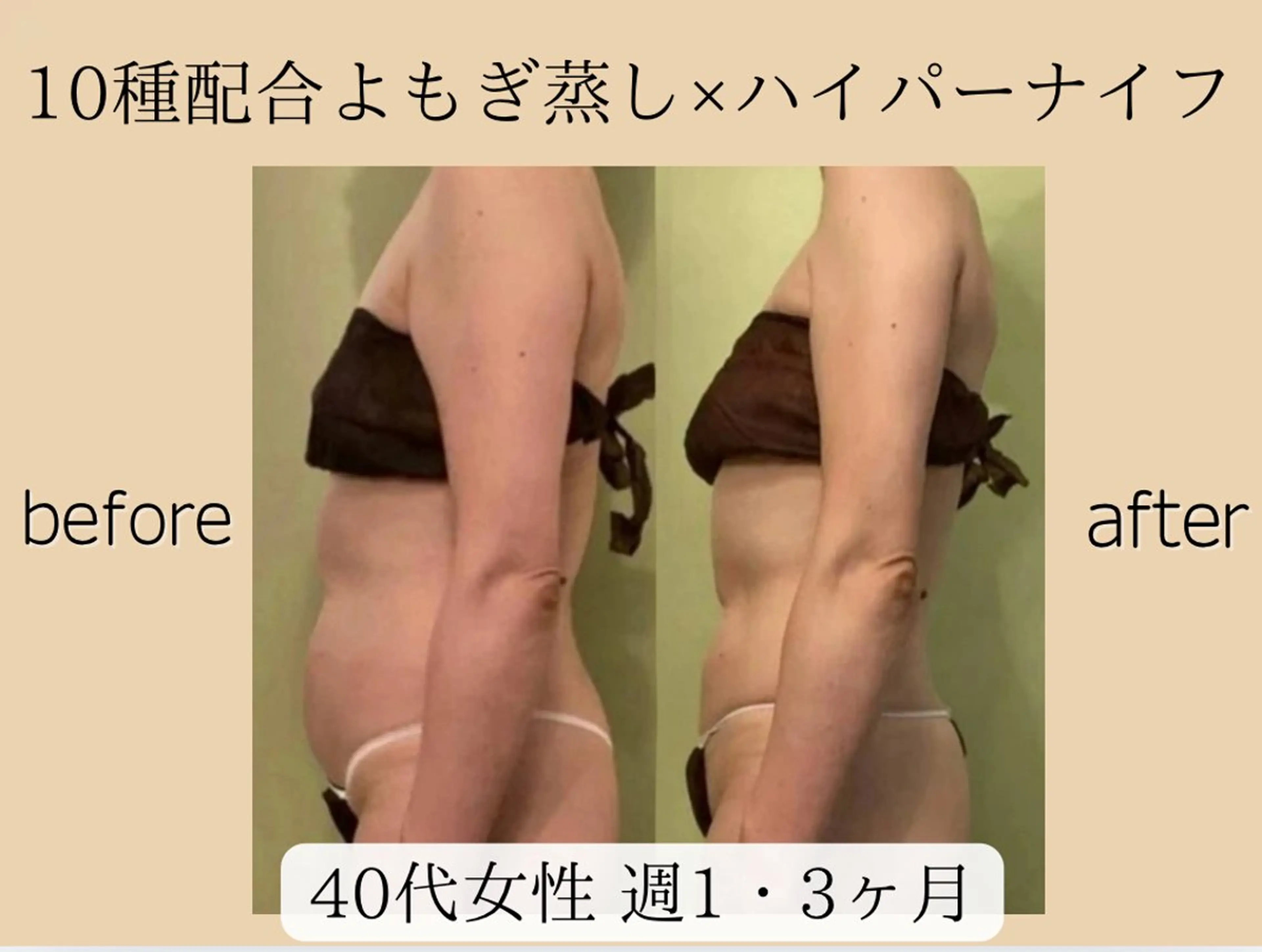 【人気No.1代謝上げ★脂肪撃退痩身】よもぎ蒸し×ハイパーナイフ×リンパマッサージの写真