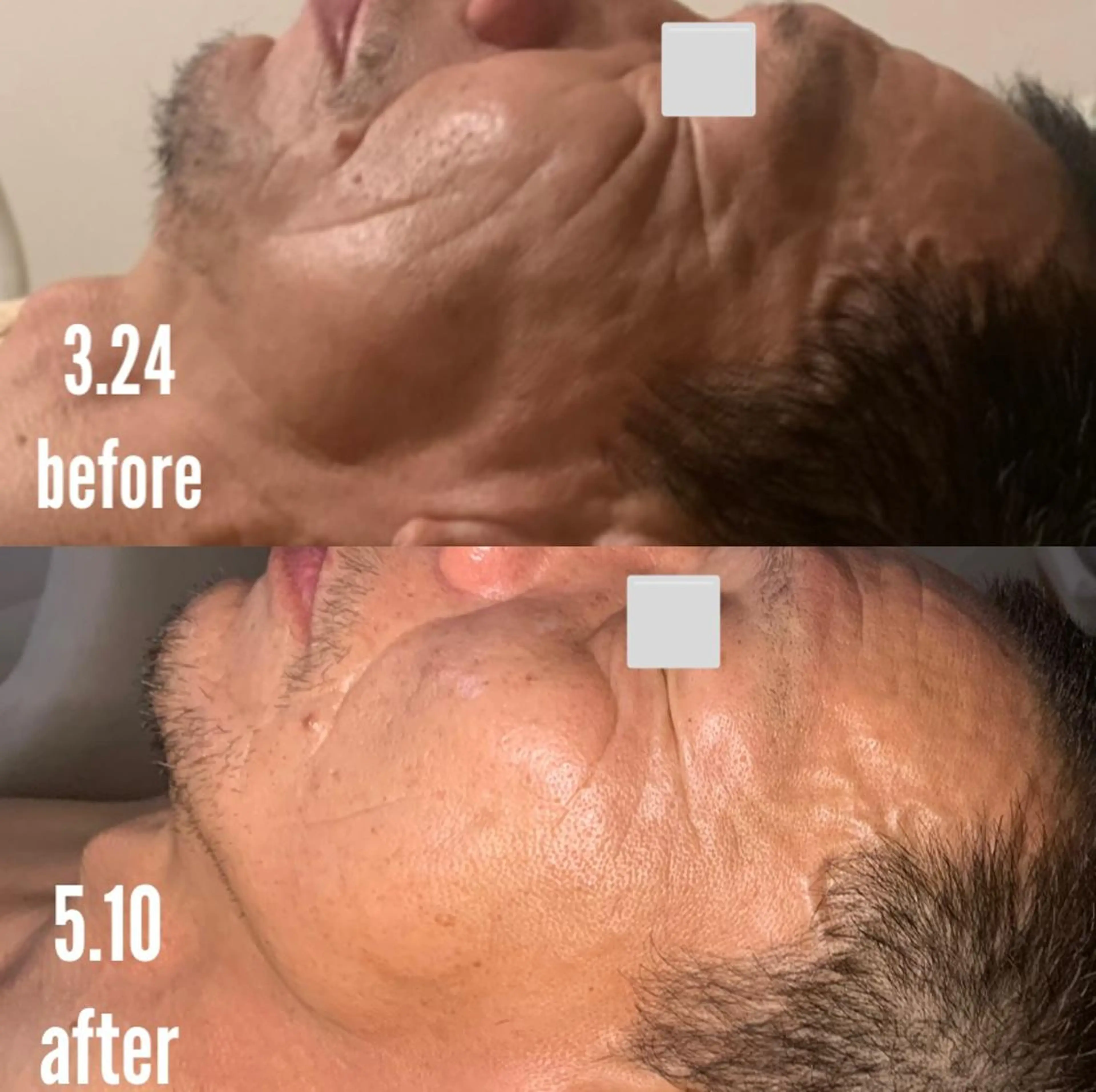 a  room salonのエステ・リラクイメージ