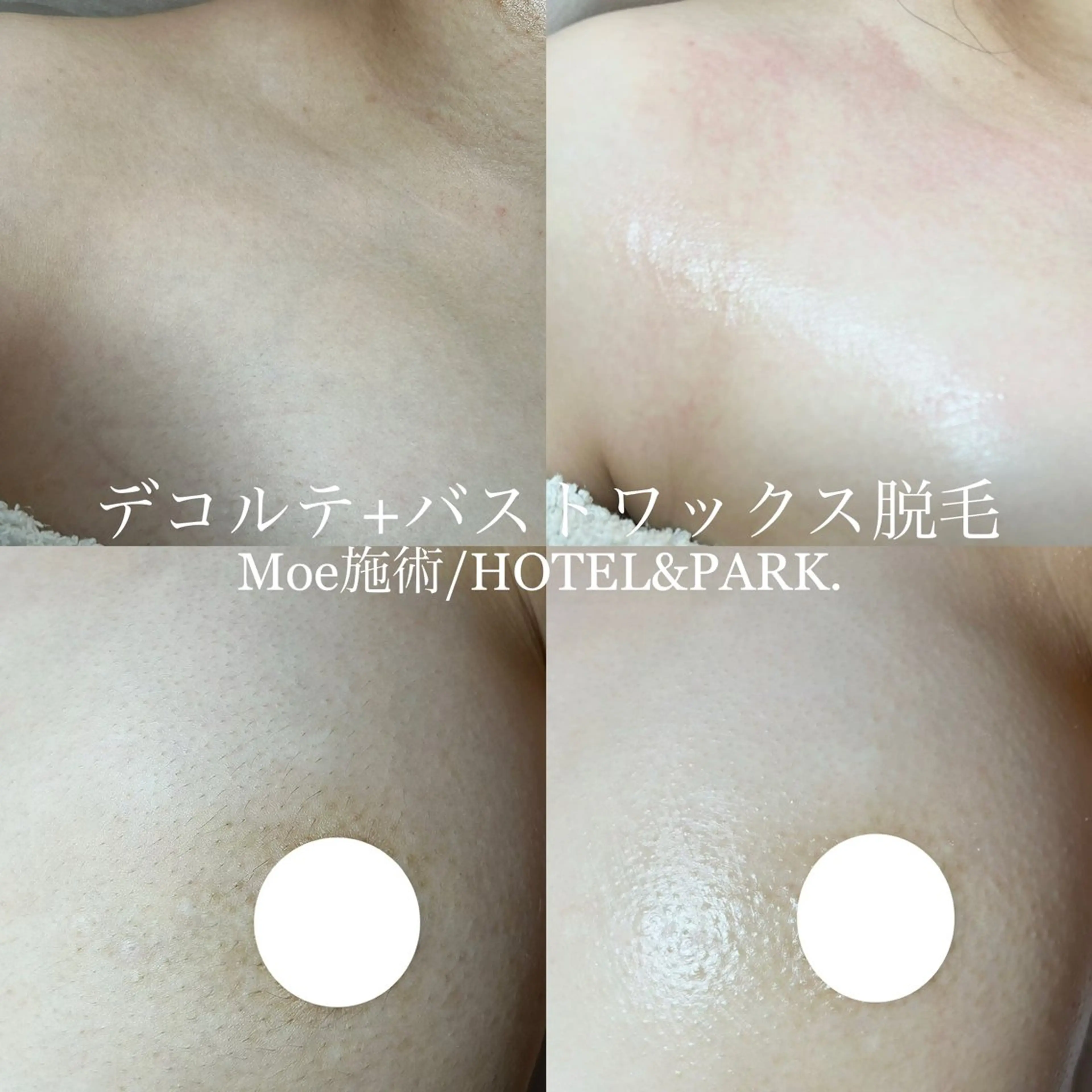 HOTEL&PARK .Moeワックス脱毛のエステ・リラクイメージ