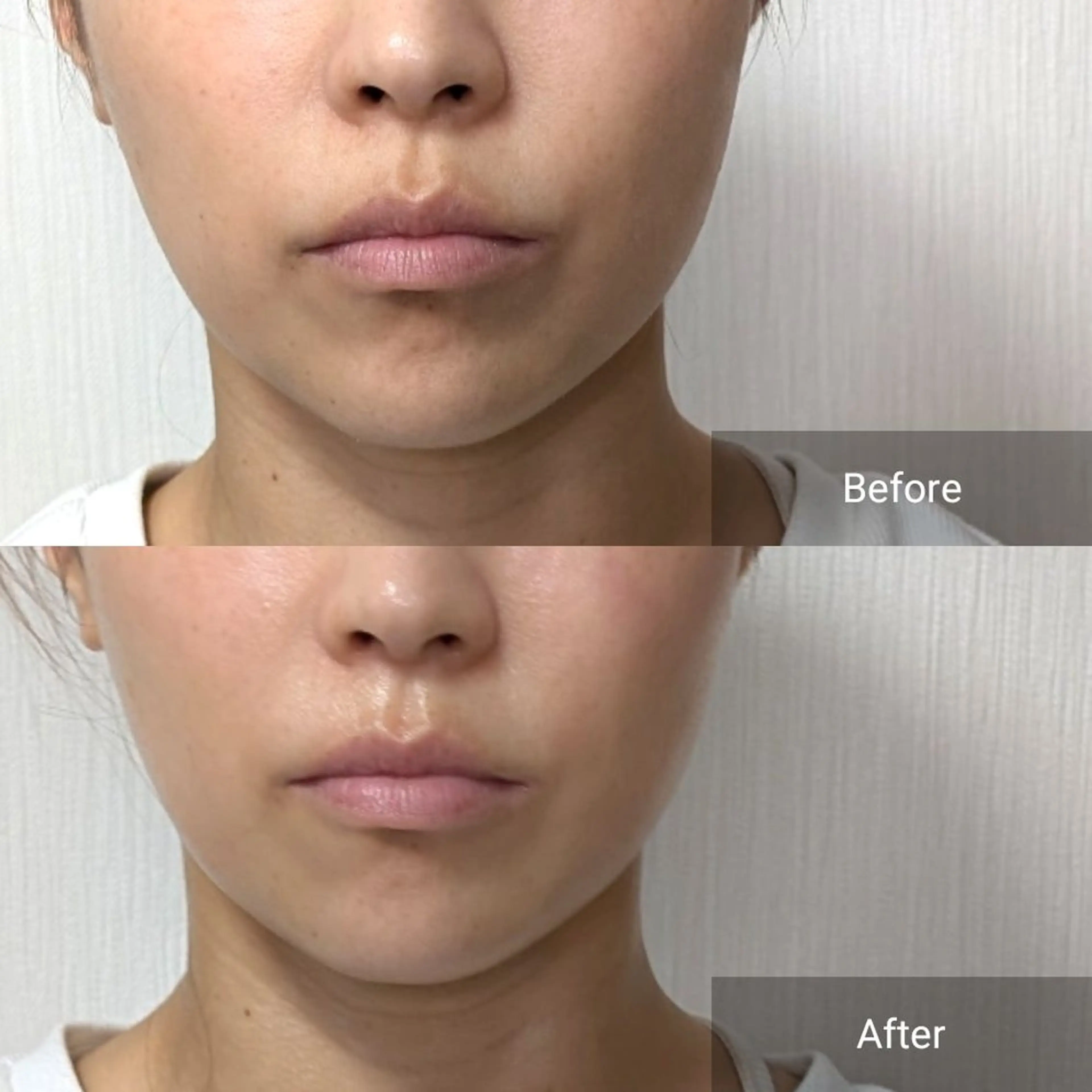 エステ nail RiRi アトレナチュラのエステ・リラクイメージ