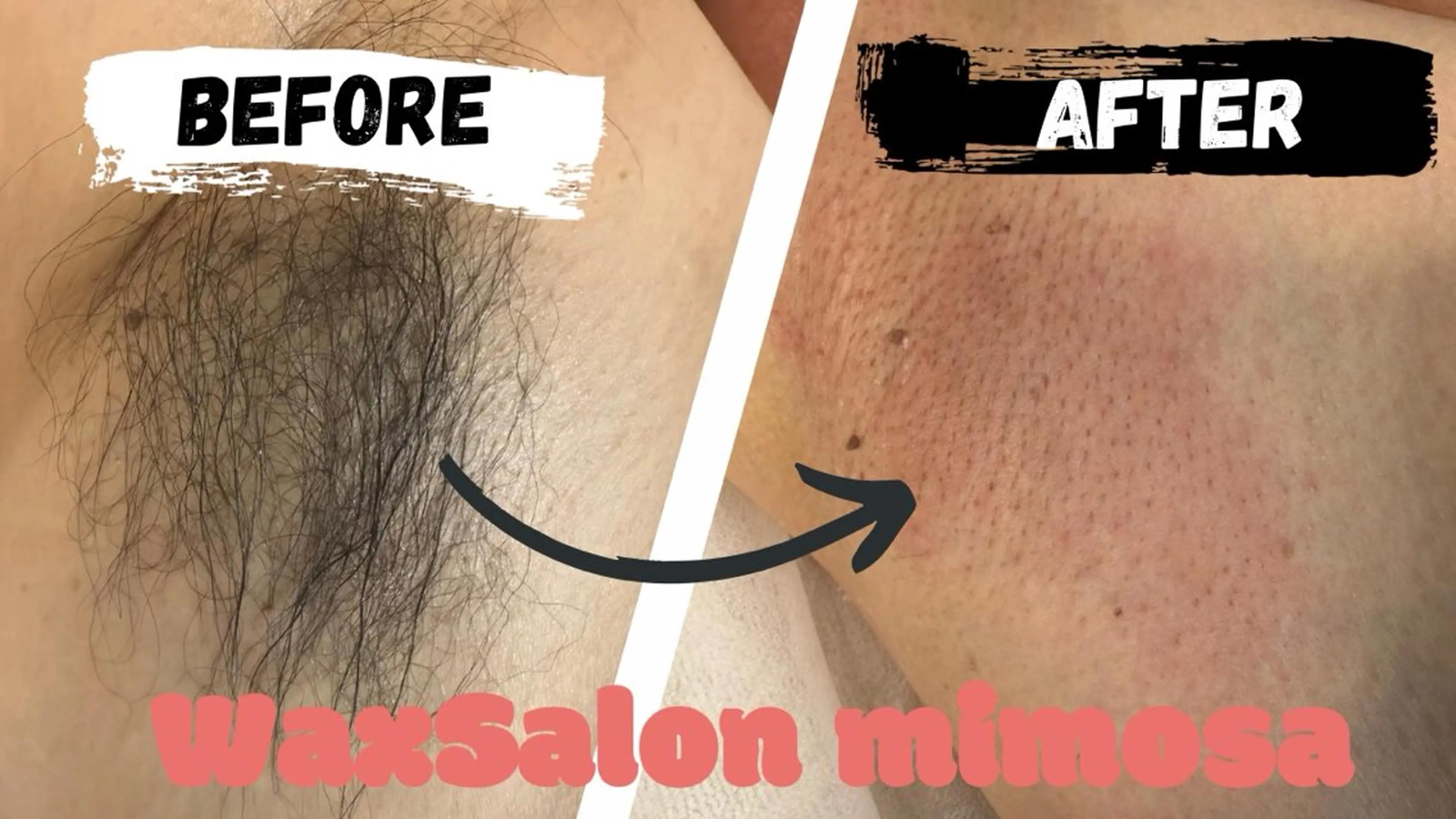 脱毛 WaxSalon mimosa所属・漆畑早香 うるしばたさやかのエステ・リラクイメージ