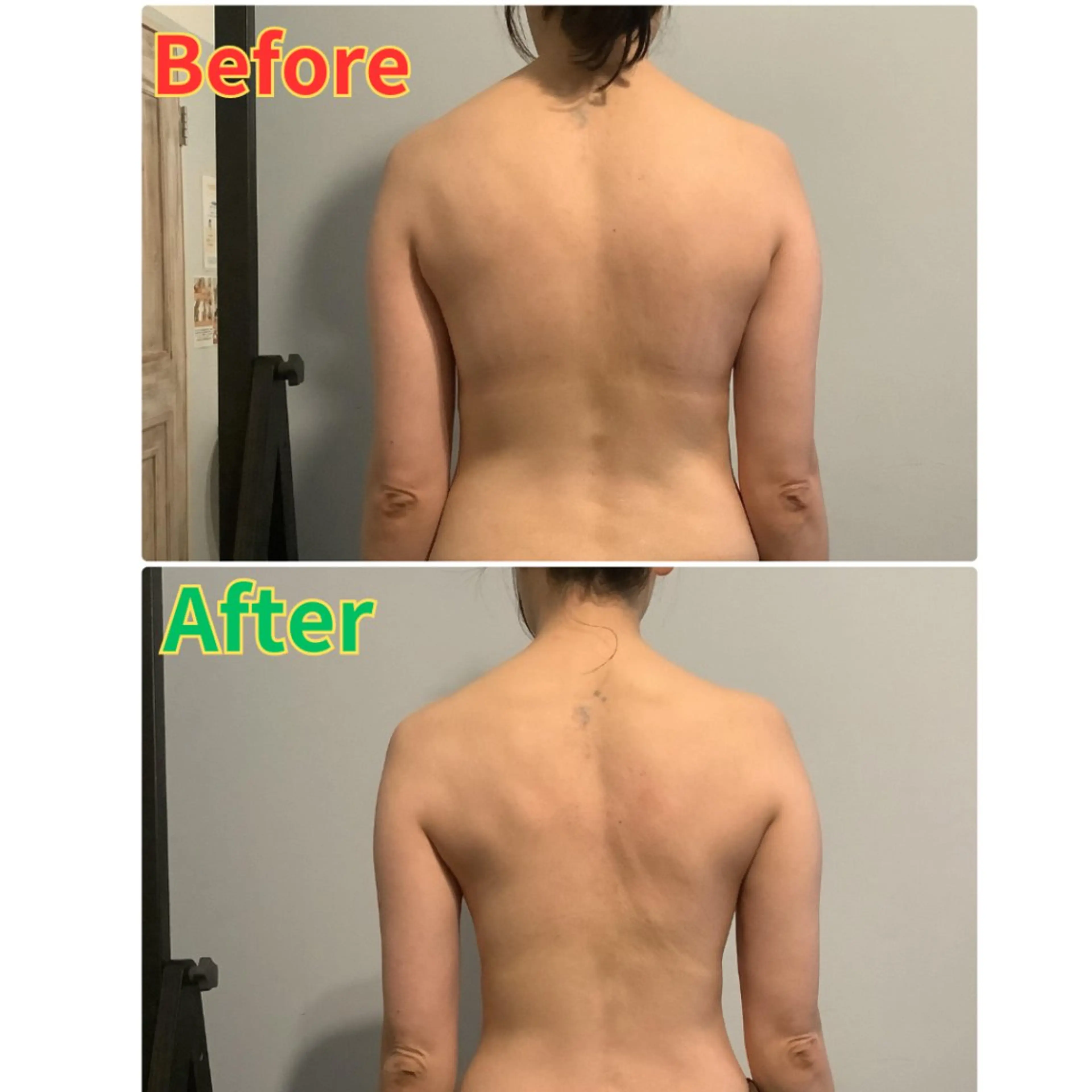 全身スッキリもみほぐしに深層筋EMS‼【もみほぐし&EMS】￥6980の写真