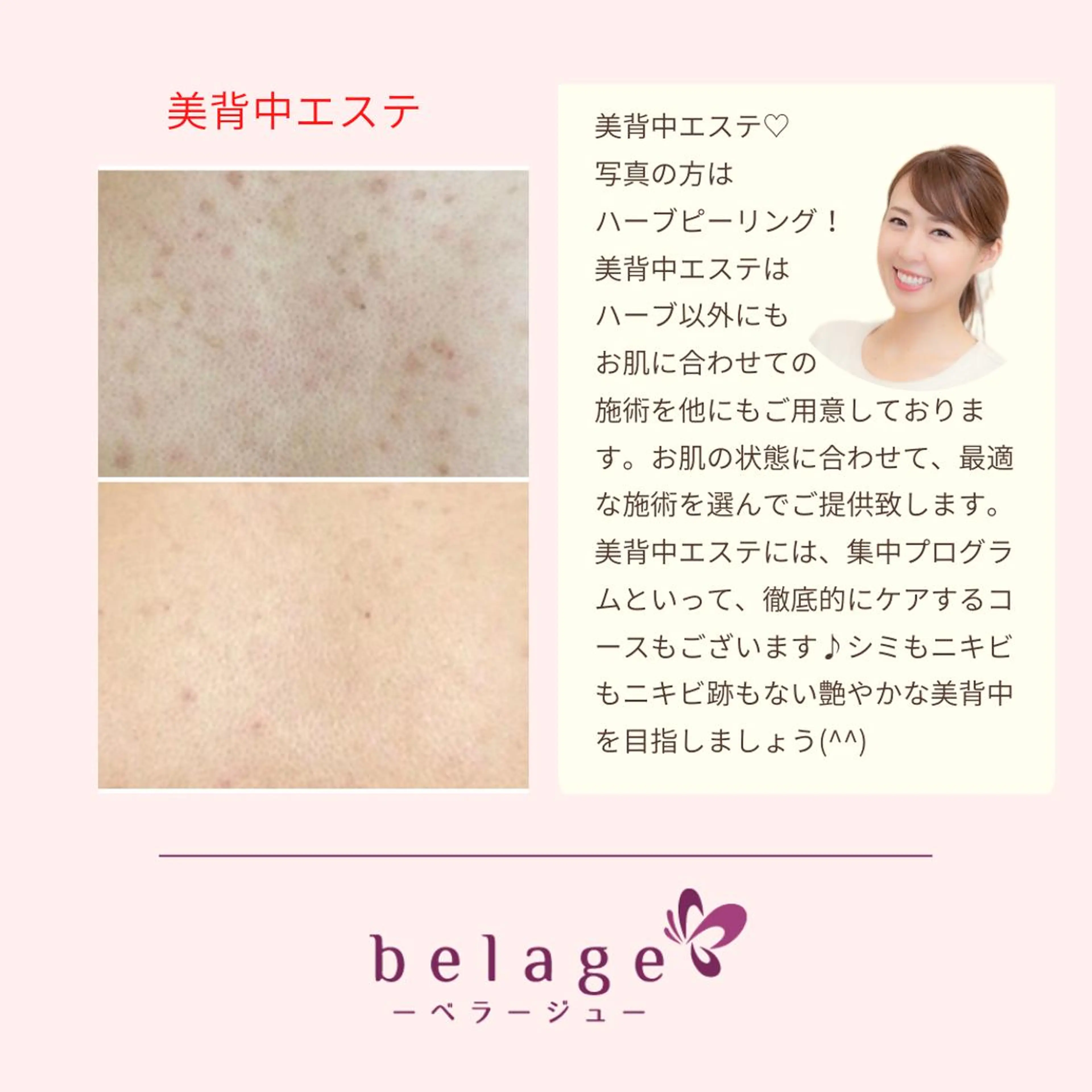 ベラージュ【美背中・ 美尻・フェイシャル】のエステ・リラクイメージ