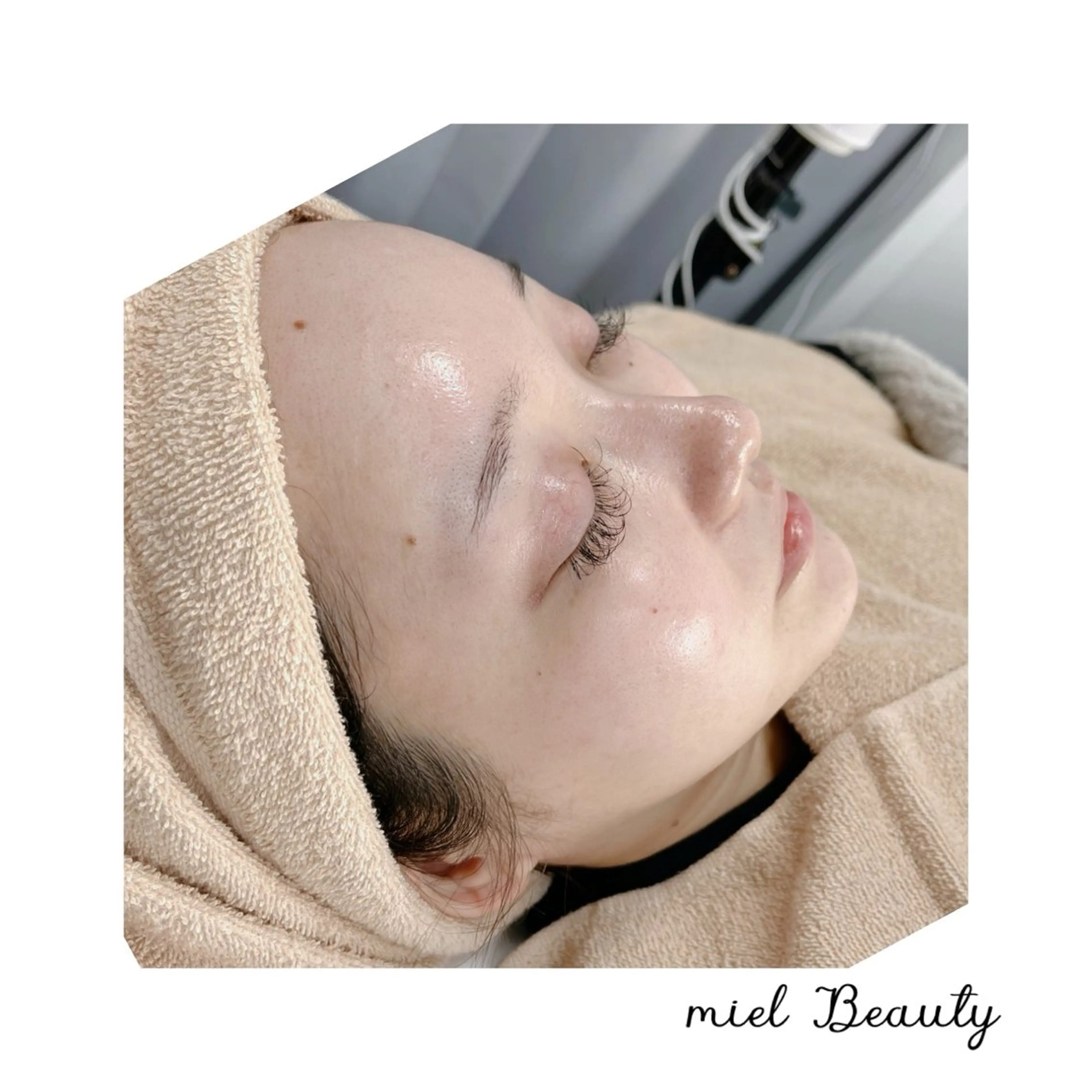 モニター様♢ララピールの写真