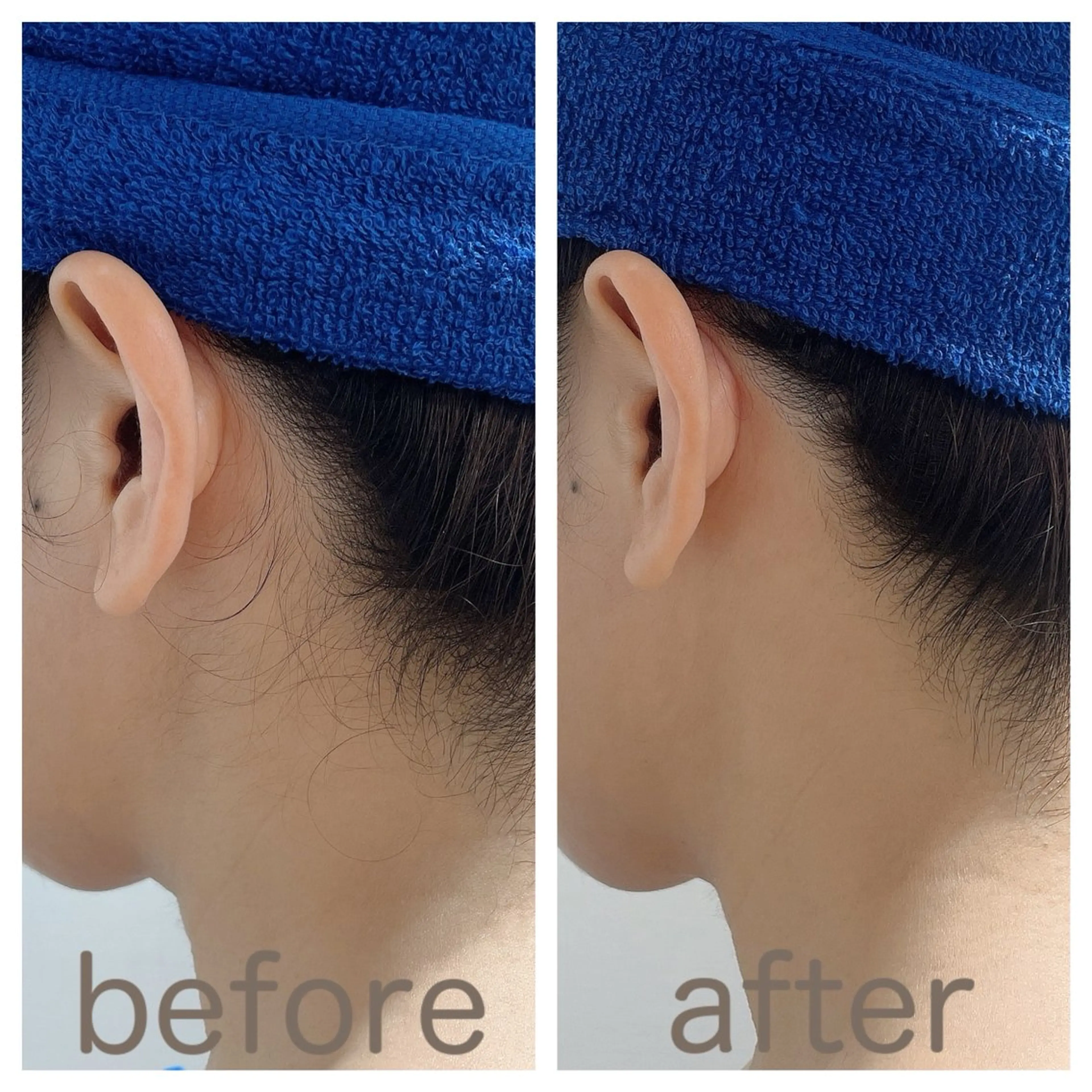 【本格シェービング】スタンダード襟足シェービング【アップスタイル・脱毛前処理に◎】の写真