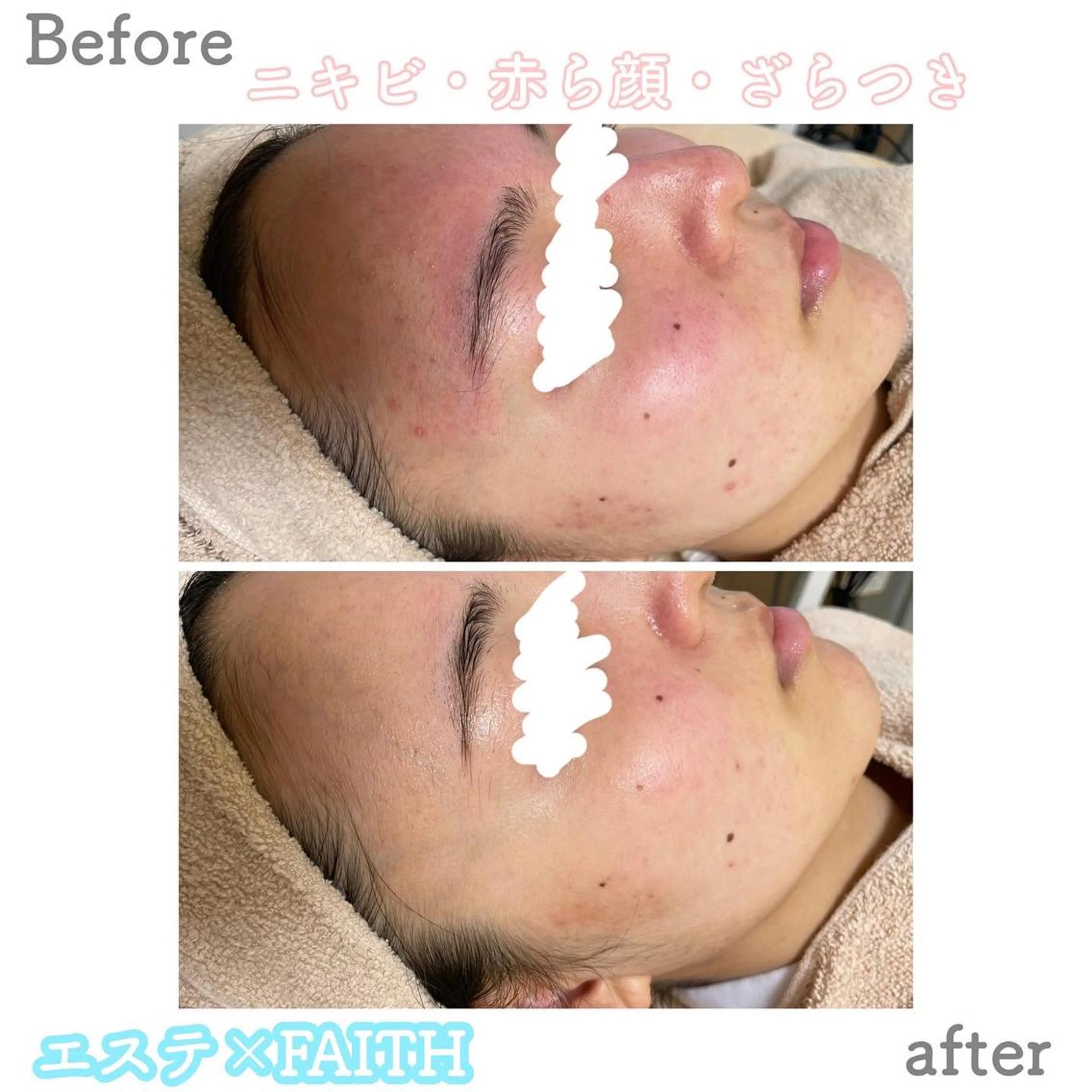 ミディアム カラー パーマ ヘアアレンジ メンズ キッズ ネイル マツエク・マツパ アイブロウ エステ ニキビ&跡改善サロン オーナー光木のエステ・リラクイメージ