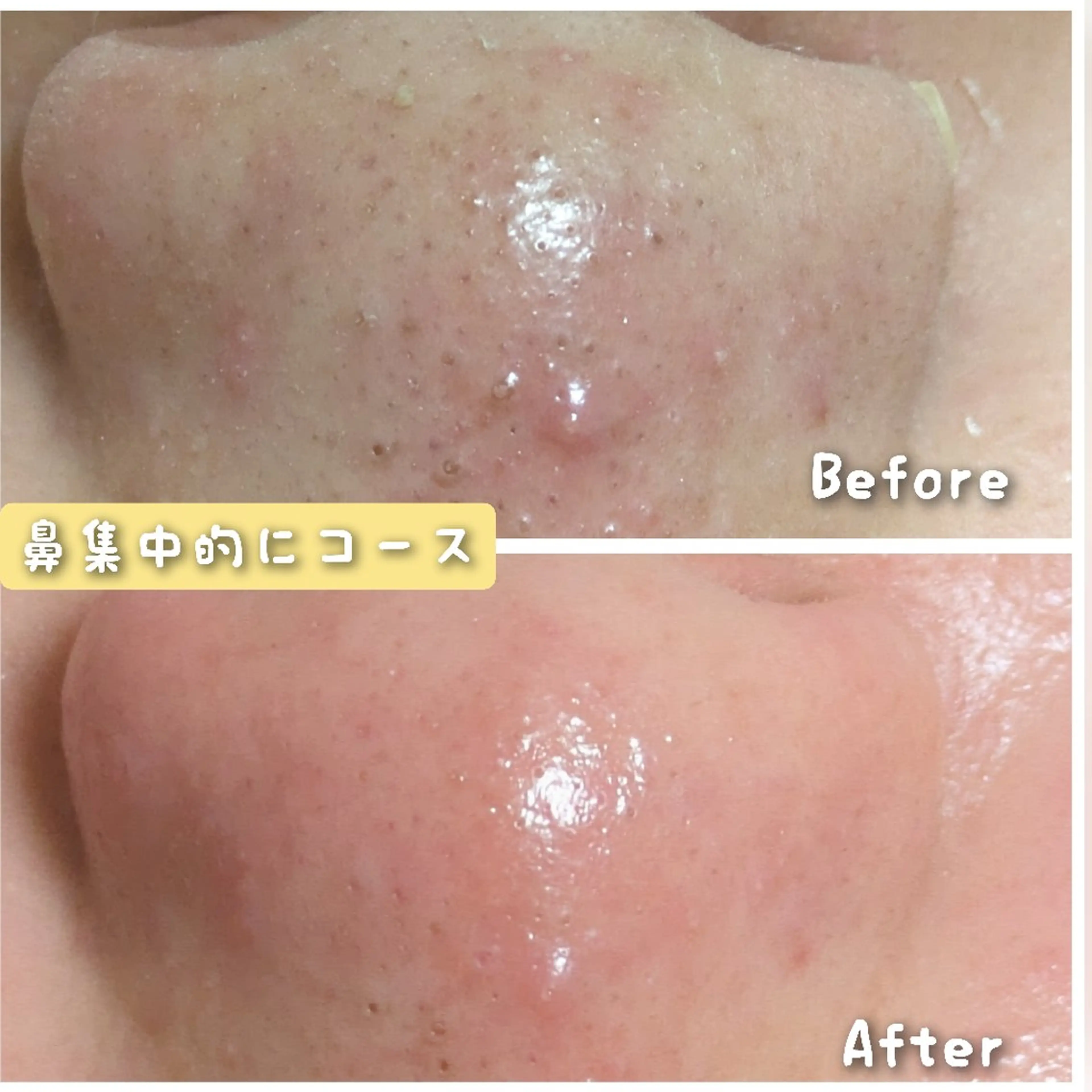 結果が出るスキンケア 肌質改善/まつパのエステ・リラクイメージ