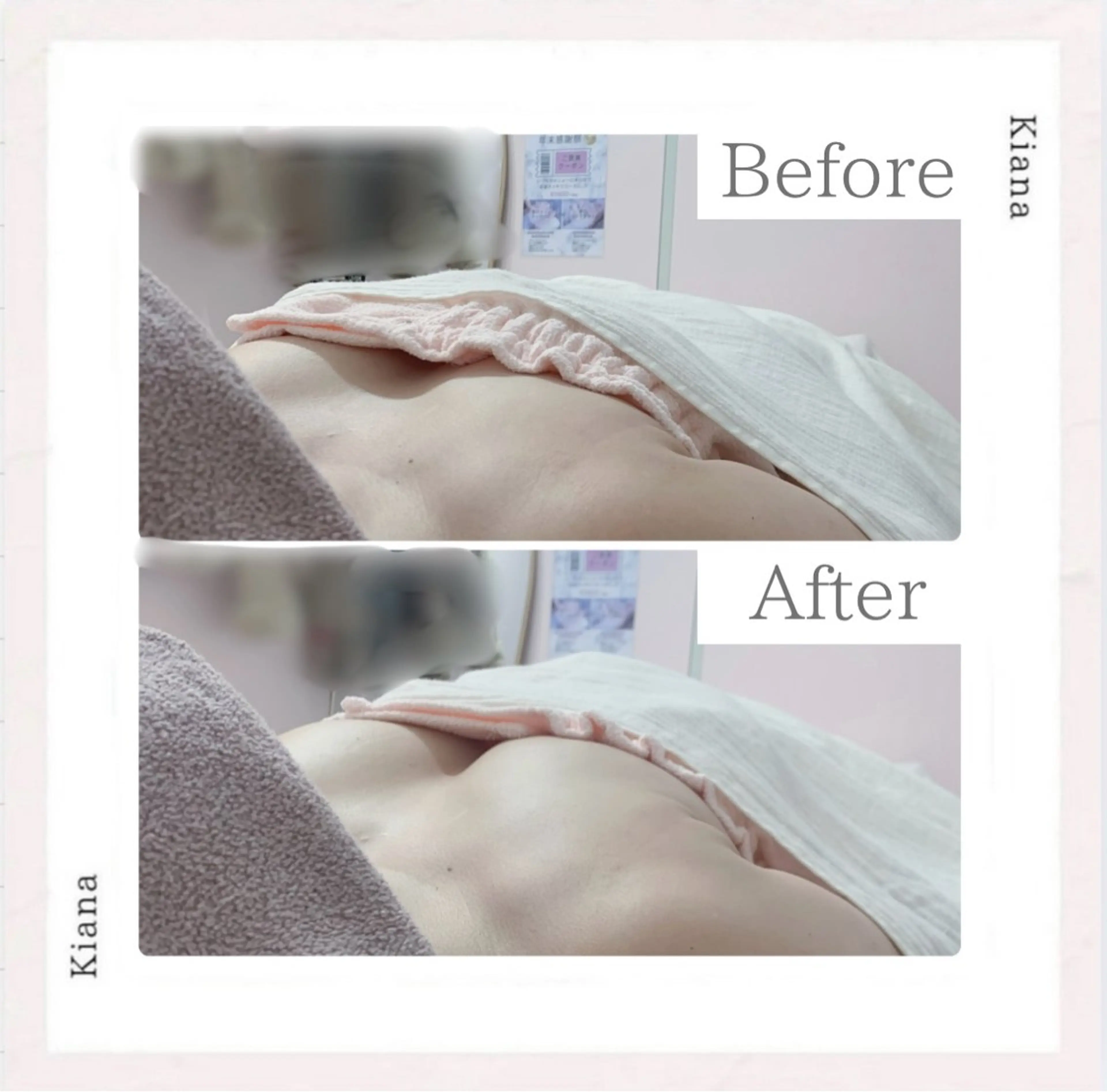 エステ リラク バスト専門Kiana 風のエステ・リラクイメージ