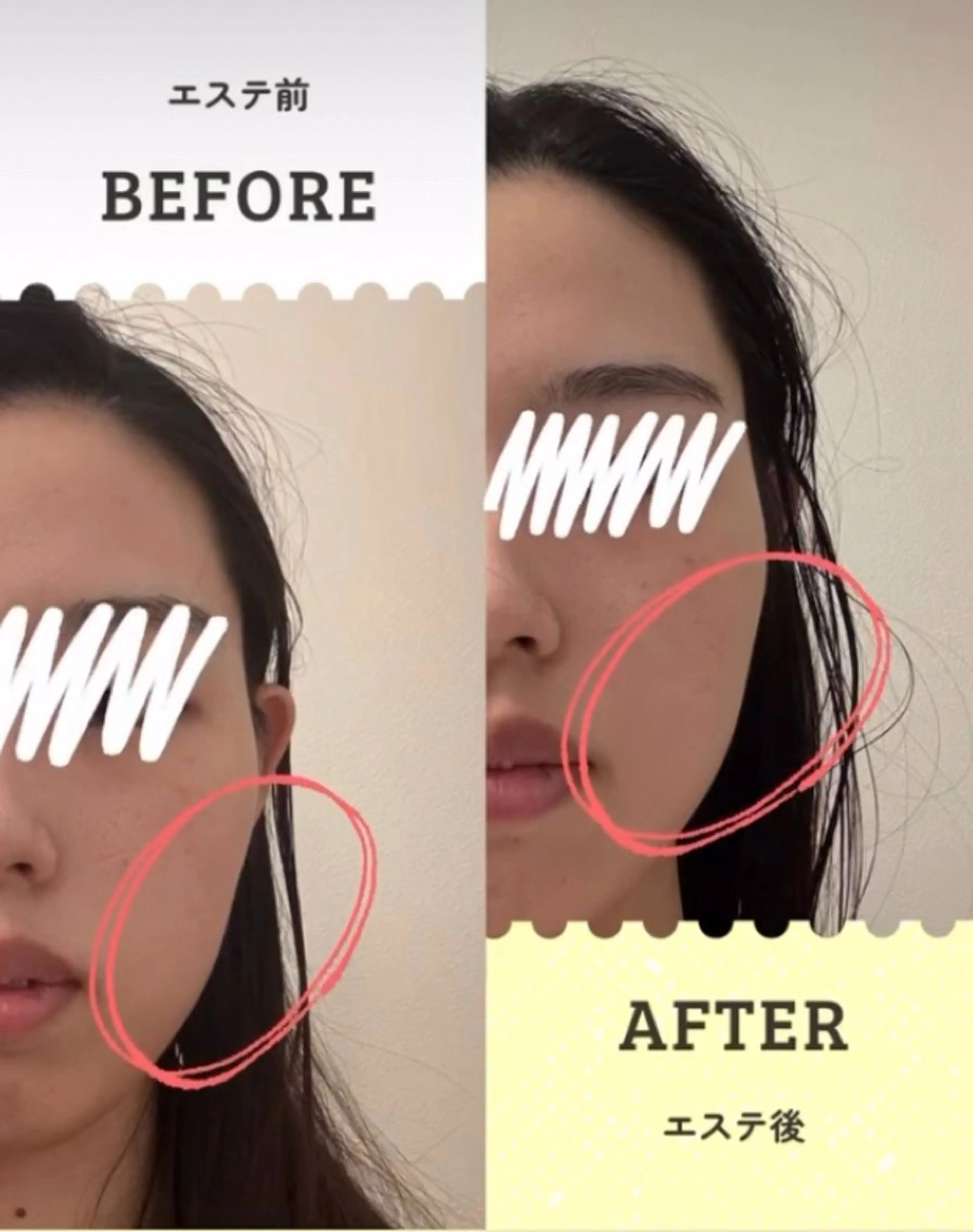 X’masエステ　ブルドッグ顎が気になる🤔ポーラ究極のビューティーハリ&ツヤリフト、驚きと感動の写真