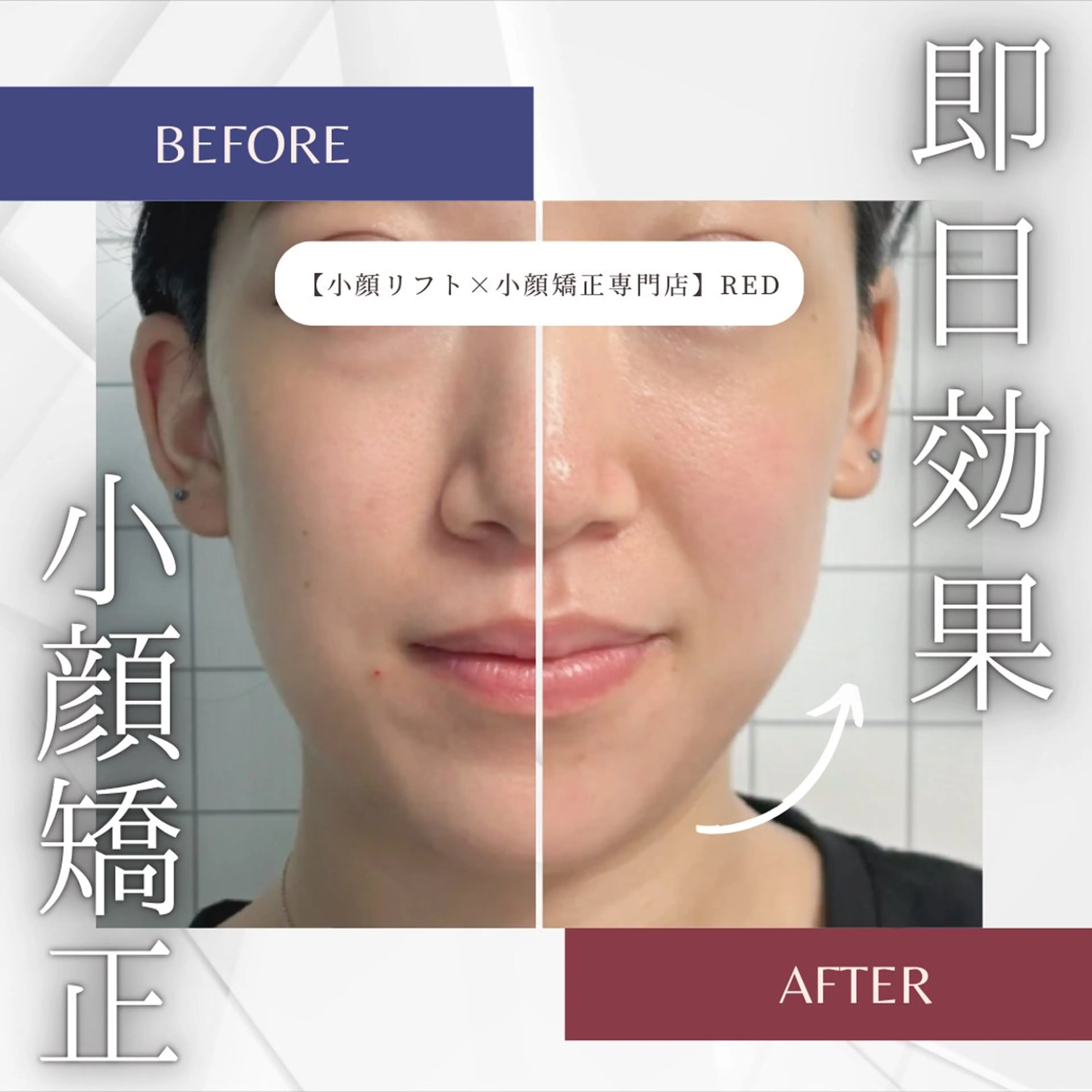 エステ リラク 小顔矯正専門店 【RED】池田のエステ・リラクイメージ