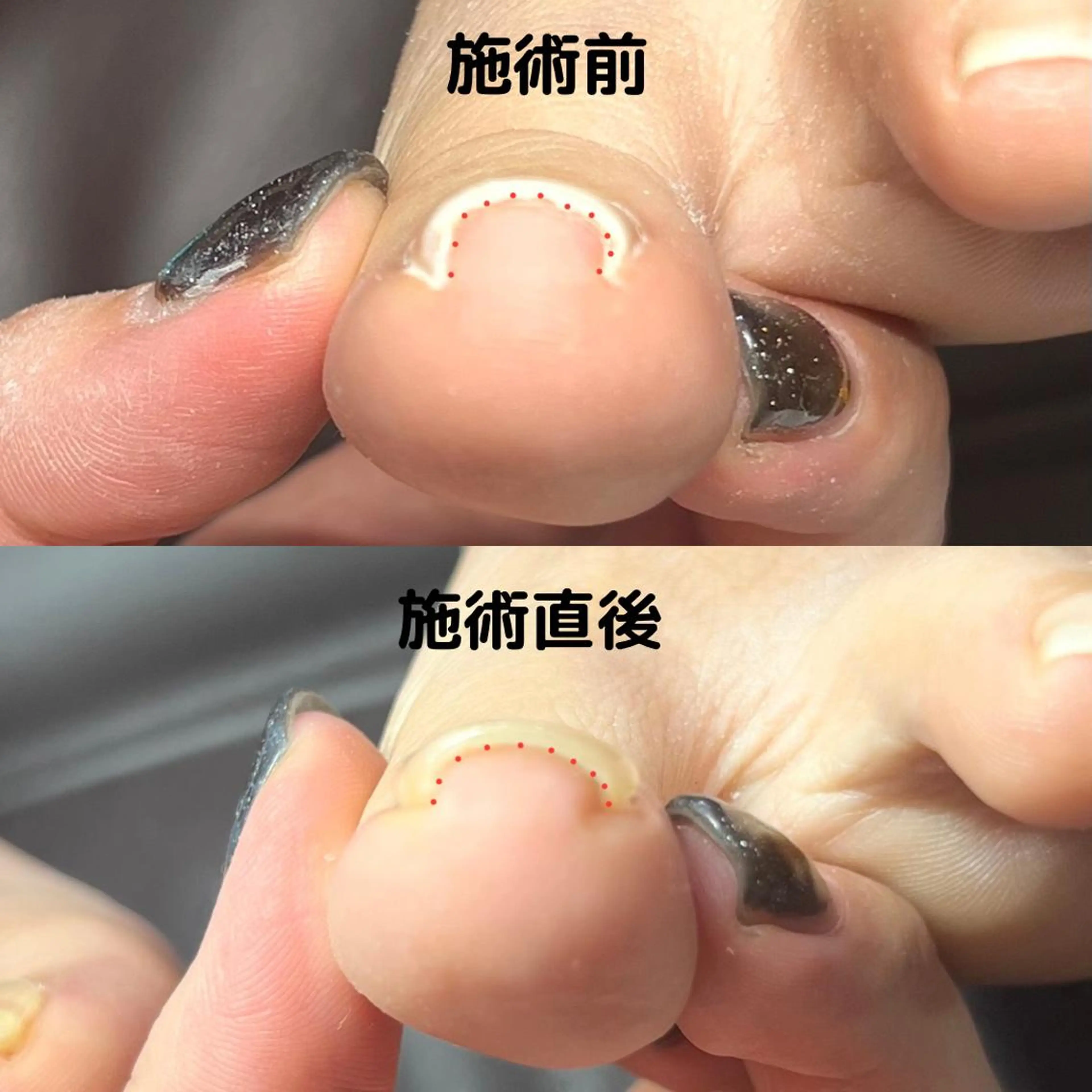 ネイル フットネイル Gatto所属・Gatto(ガット) ヤマモトのネイルデザイン