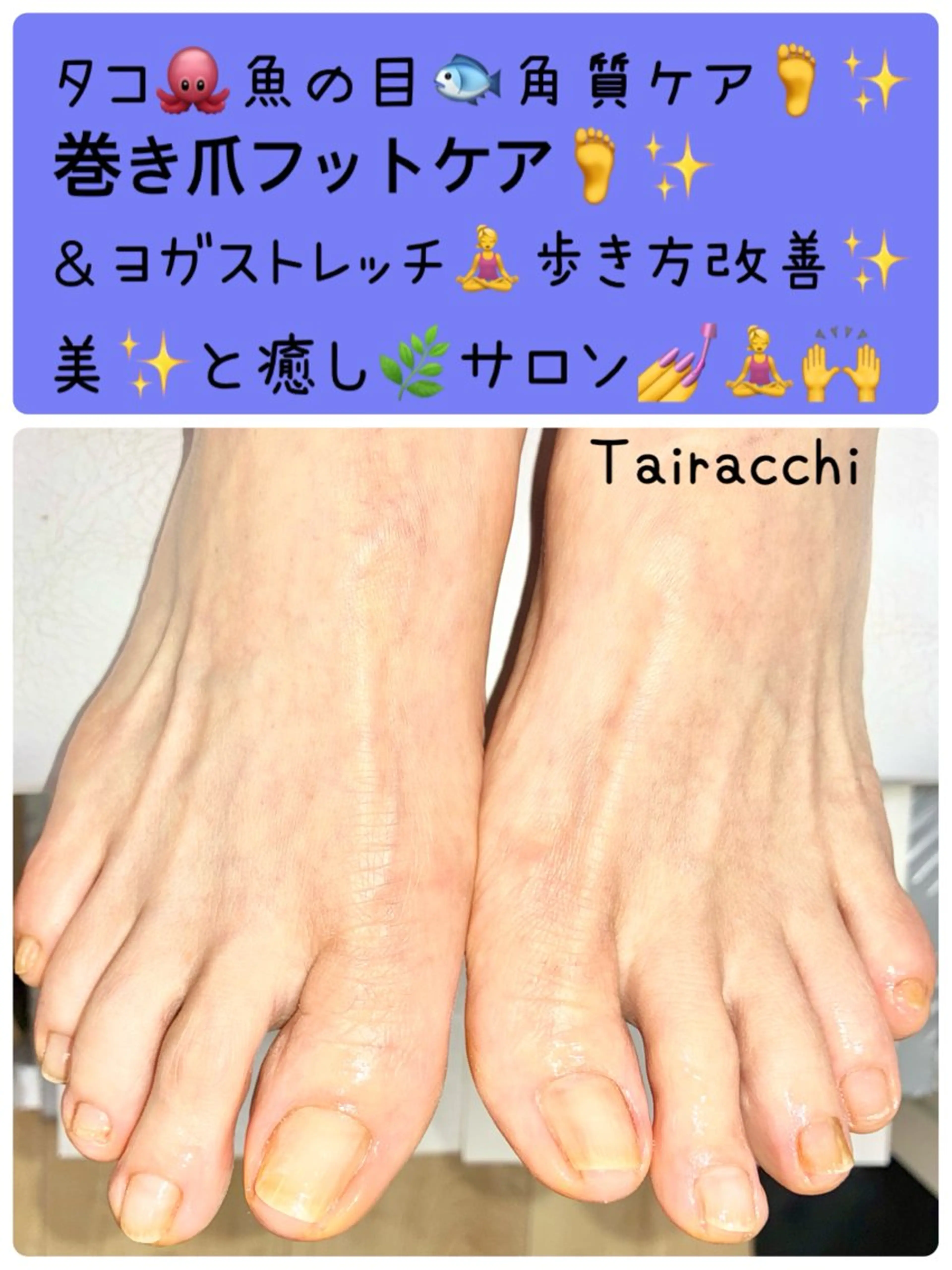 ネイル フットネイル Tairacchi タイラッチのエステ・リラクイメージ