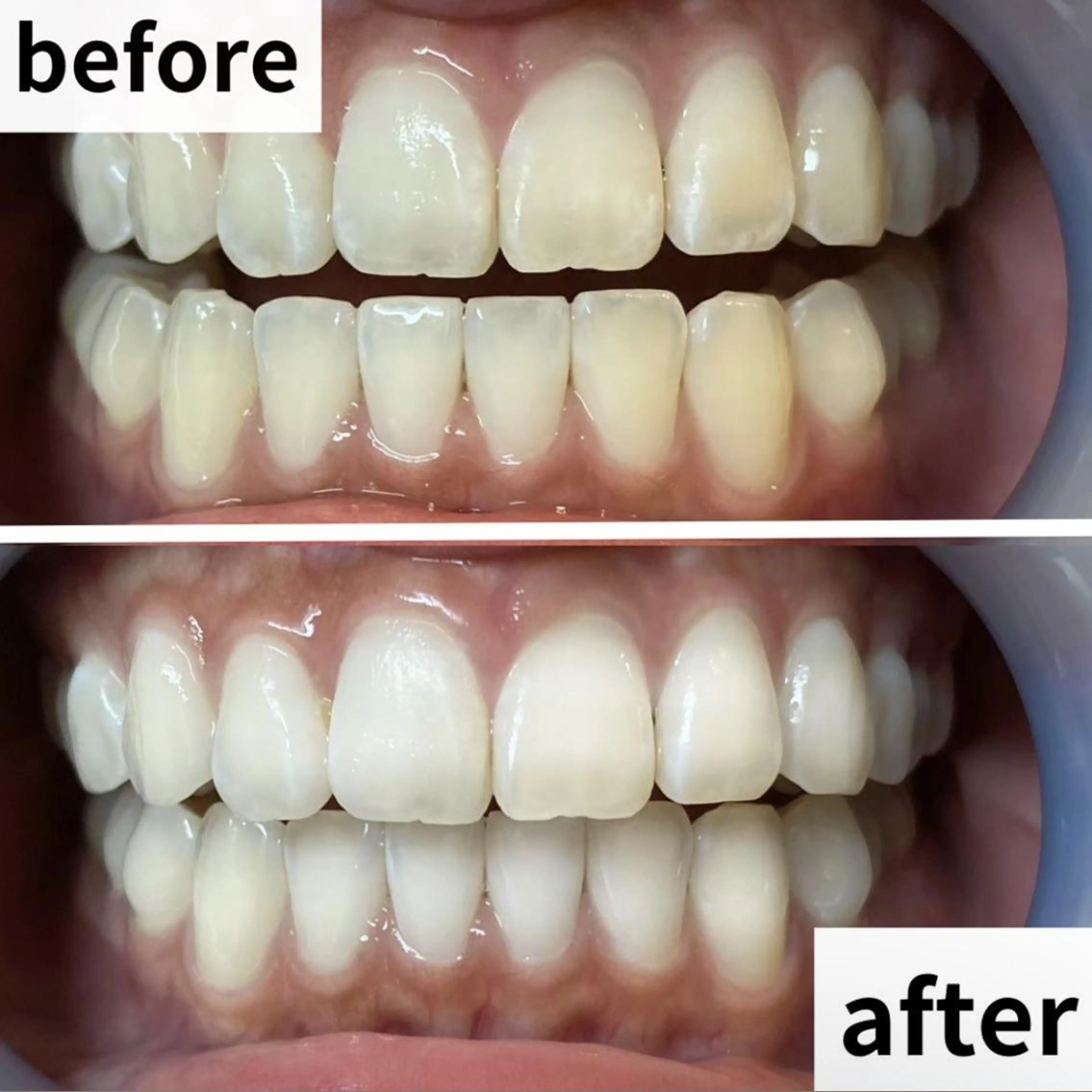 LBSホワイトニング 🌐渋谷店 小河原のエステ・リラクイメージ