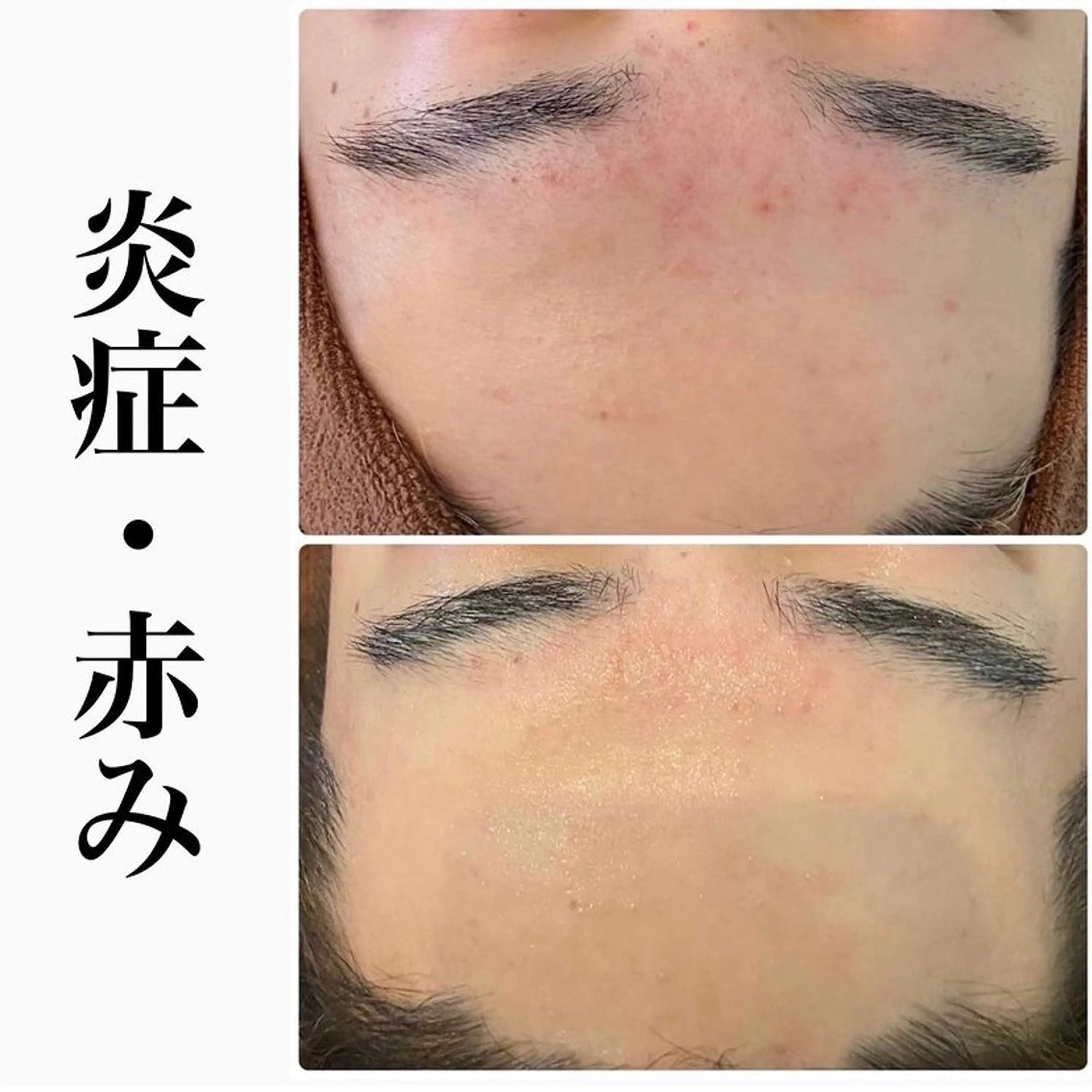 ハーブピーリング専門 BIOEL横浜のエステ・リラクイメージ