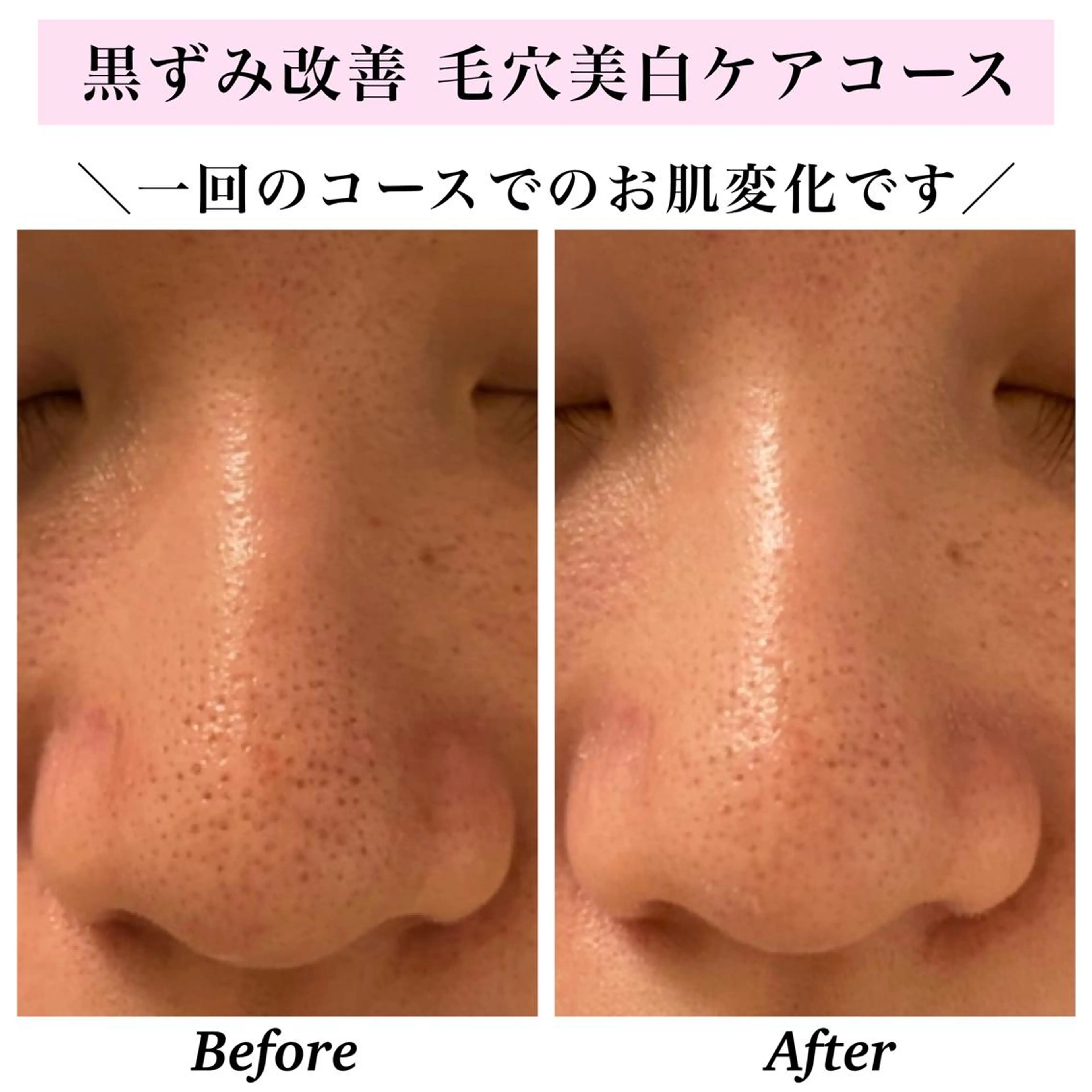 エステ リラク Bellesthe （ベルエステ）のエステ・リラクイメージ