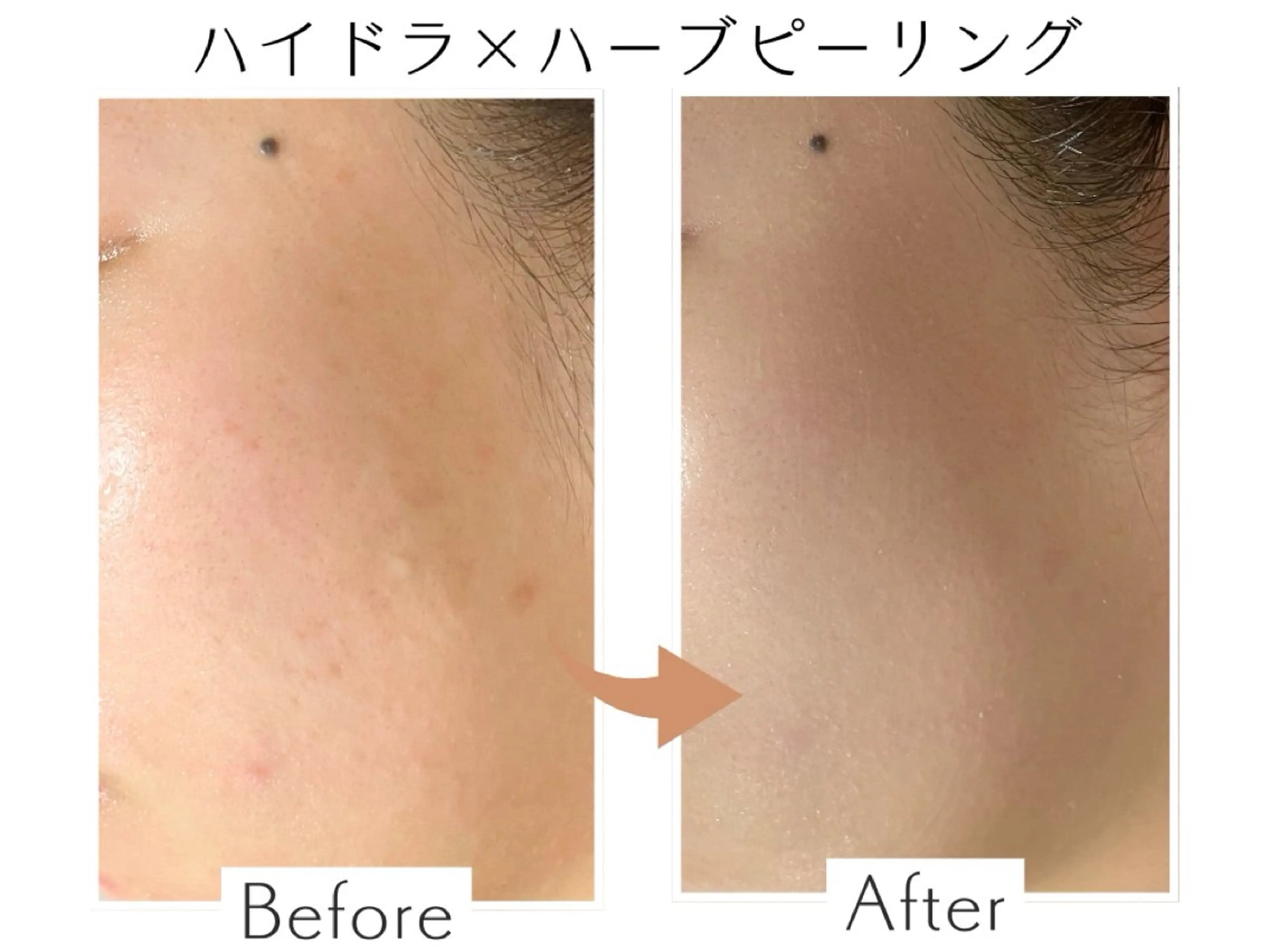 エステ プライベートサロン Belle（ベル）のエステ・リラクイメージ