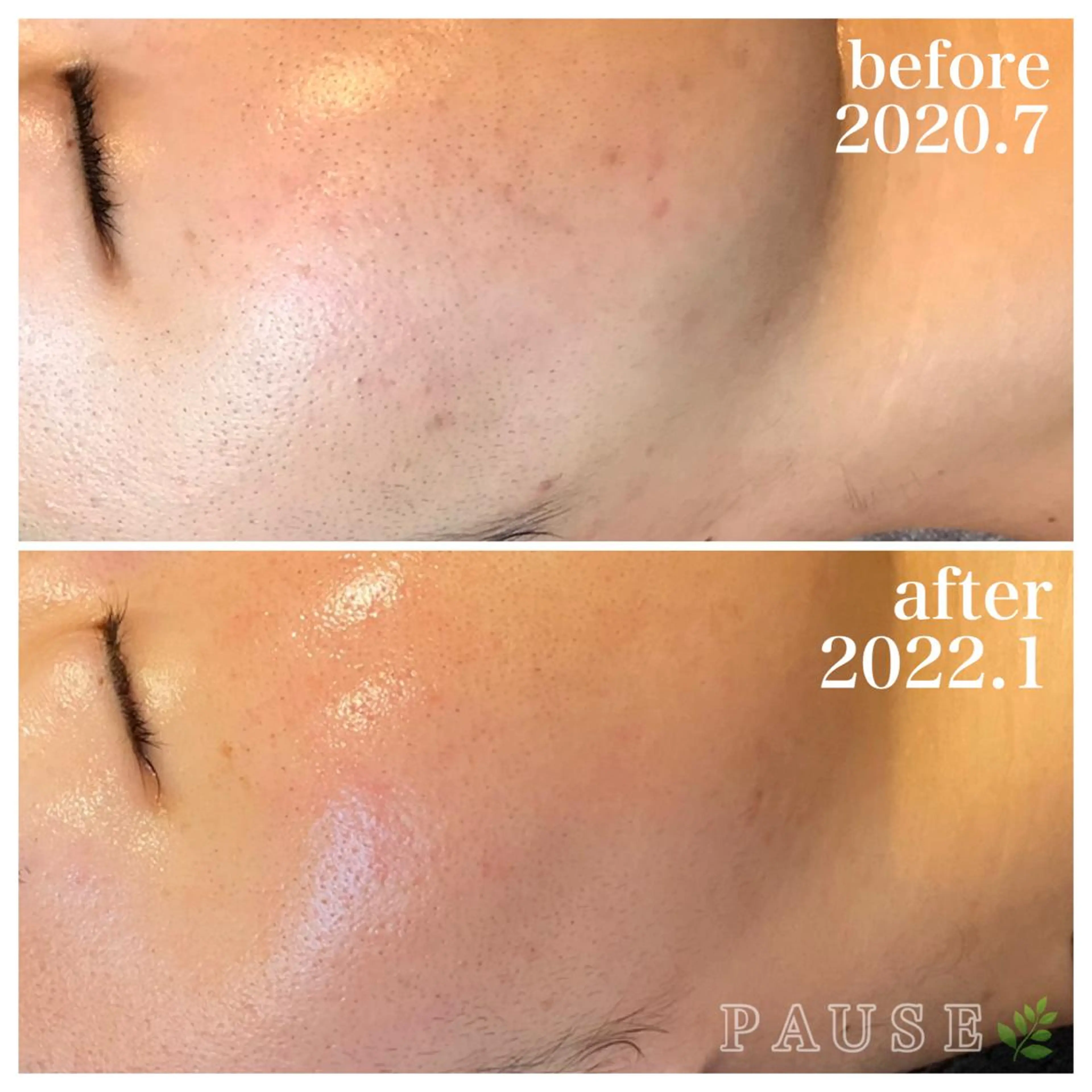 エステ 浜野 恵美のエステ・リラクイメージ