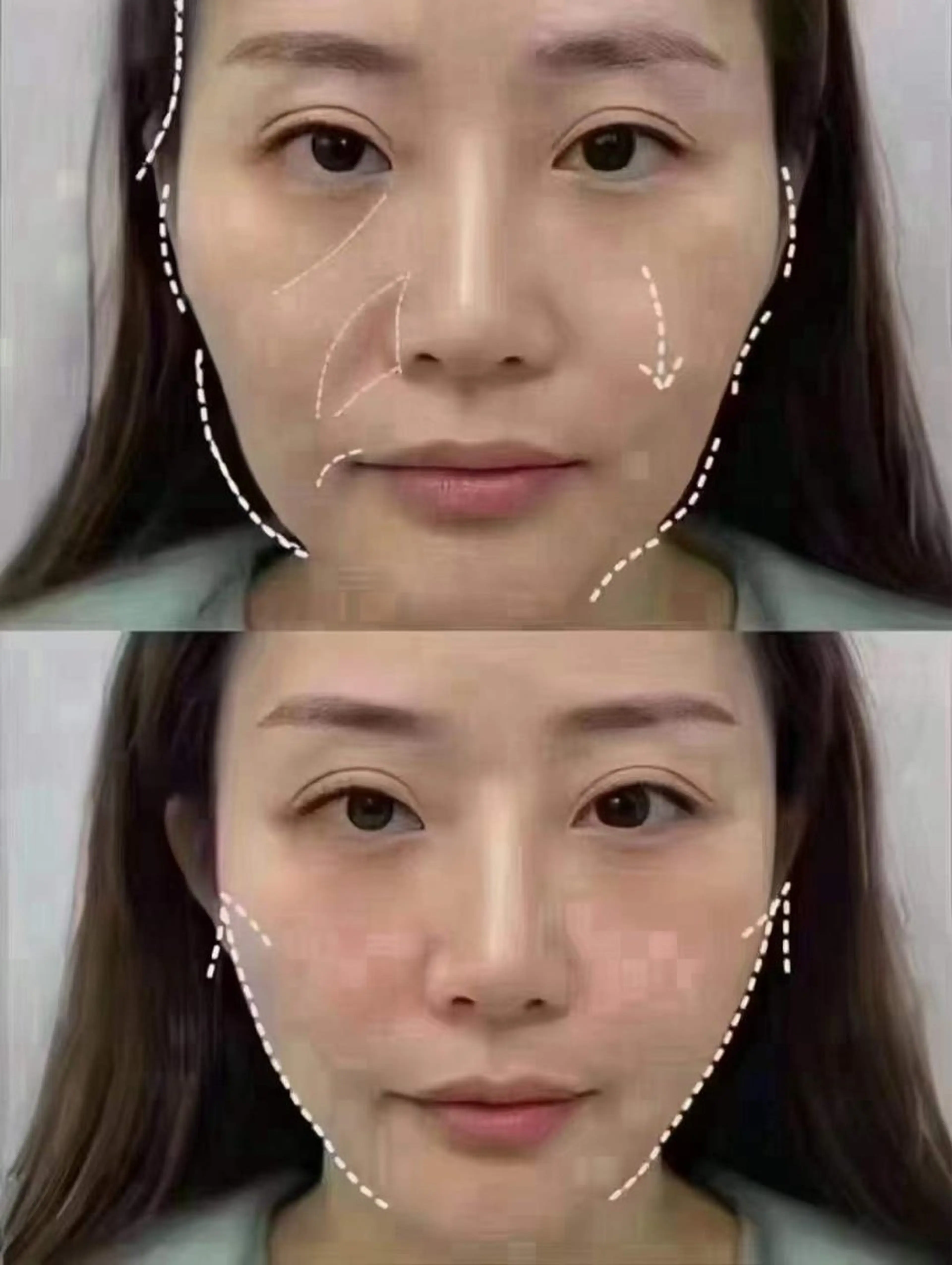 エステ リラク 愛維美水光美肌専門店所属・愛維美水光美肌専門店 メンズレディースokのエステ・リラクイメージ