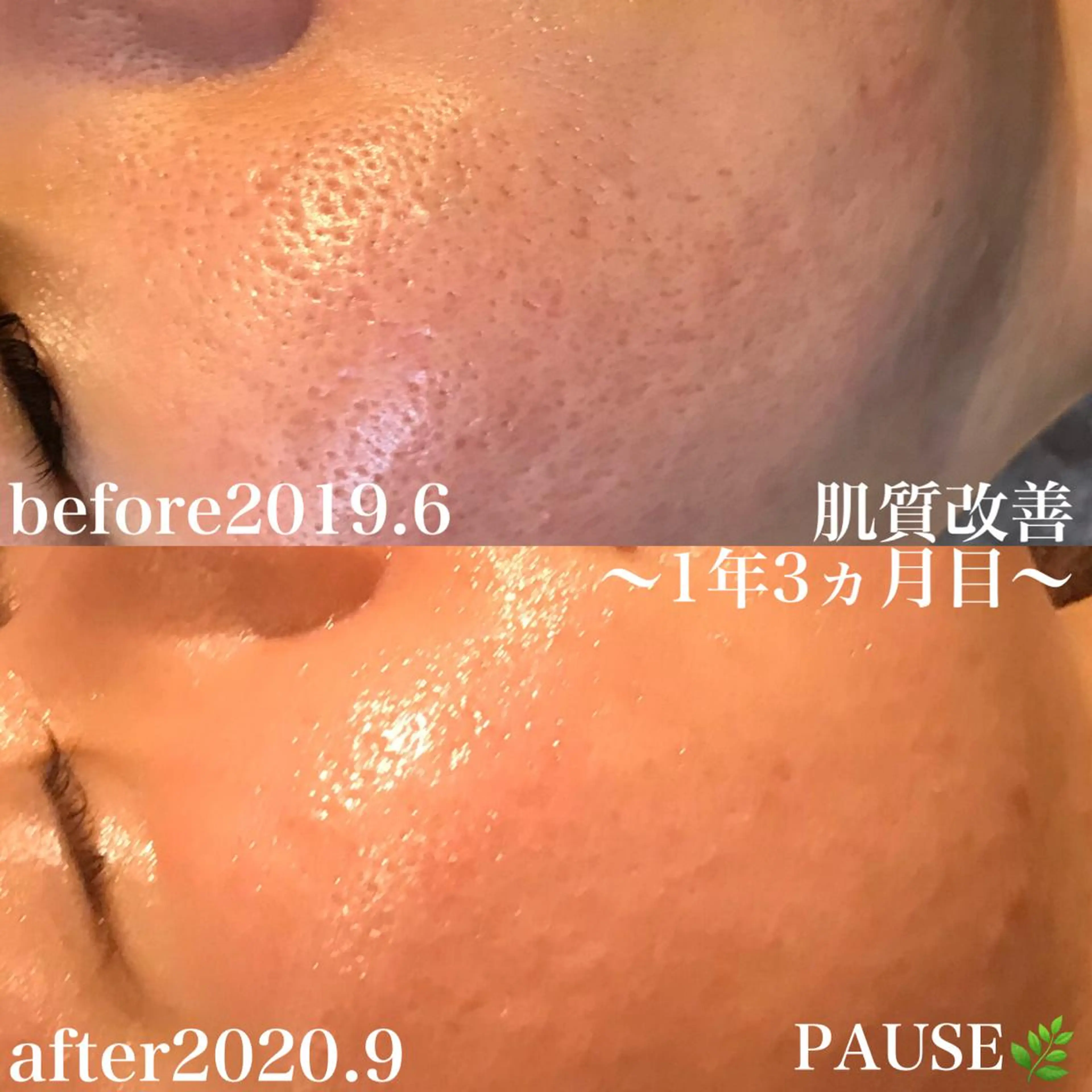 エステ 浜野 恵美のエステ・リラクイメージ