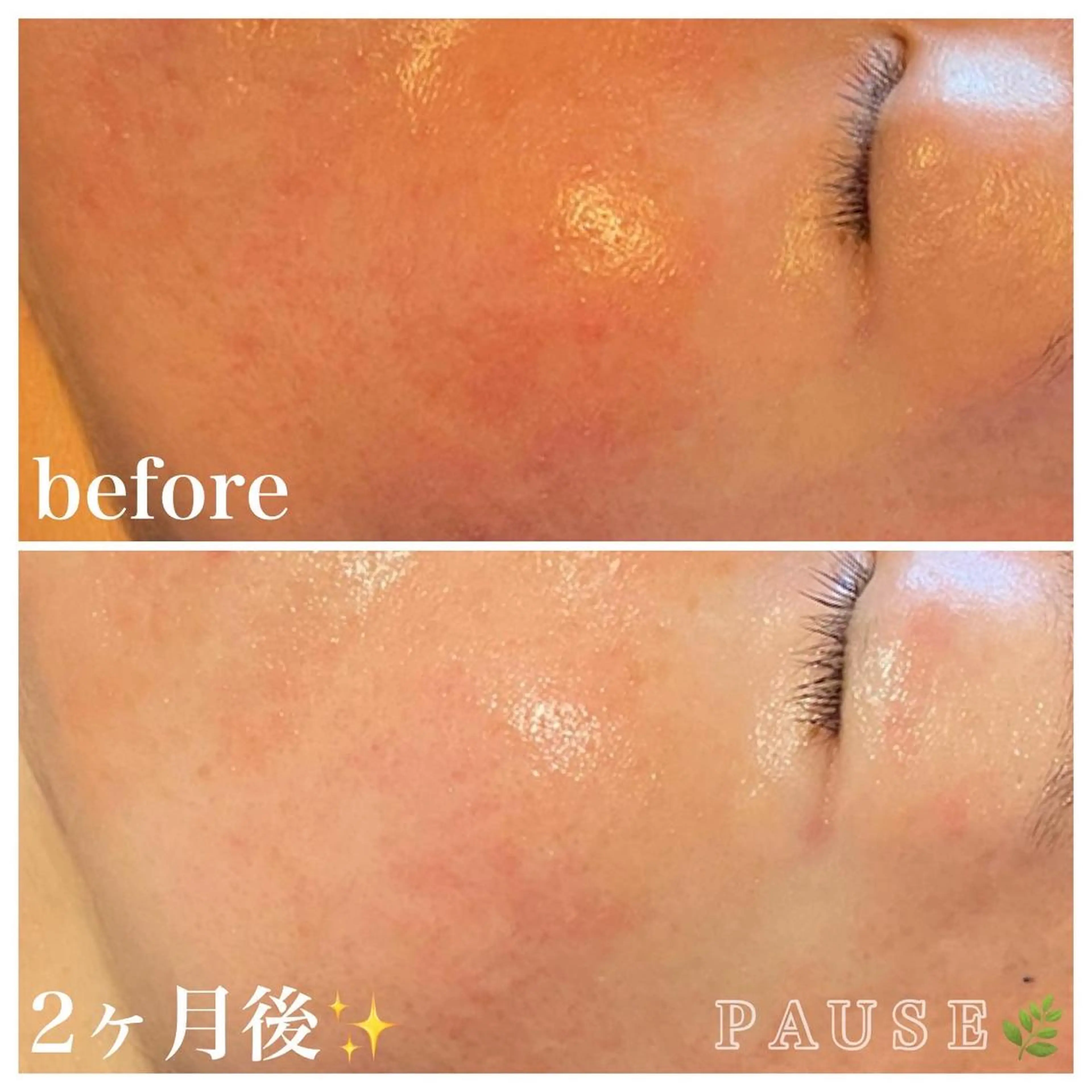 エステ リラク 浜野 恵美のエステ・リラクイメージ