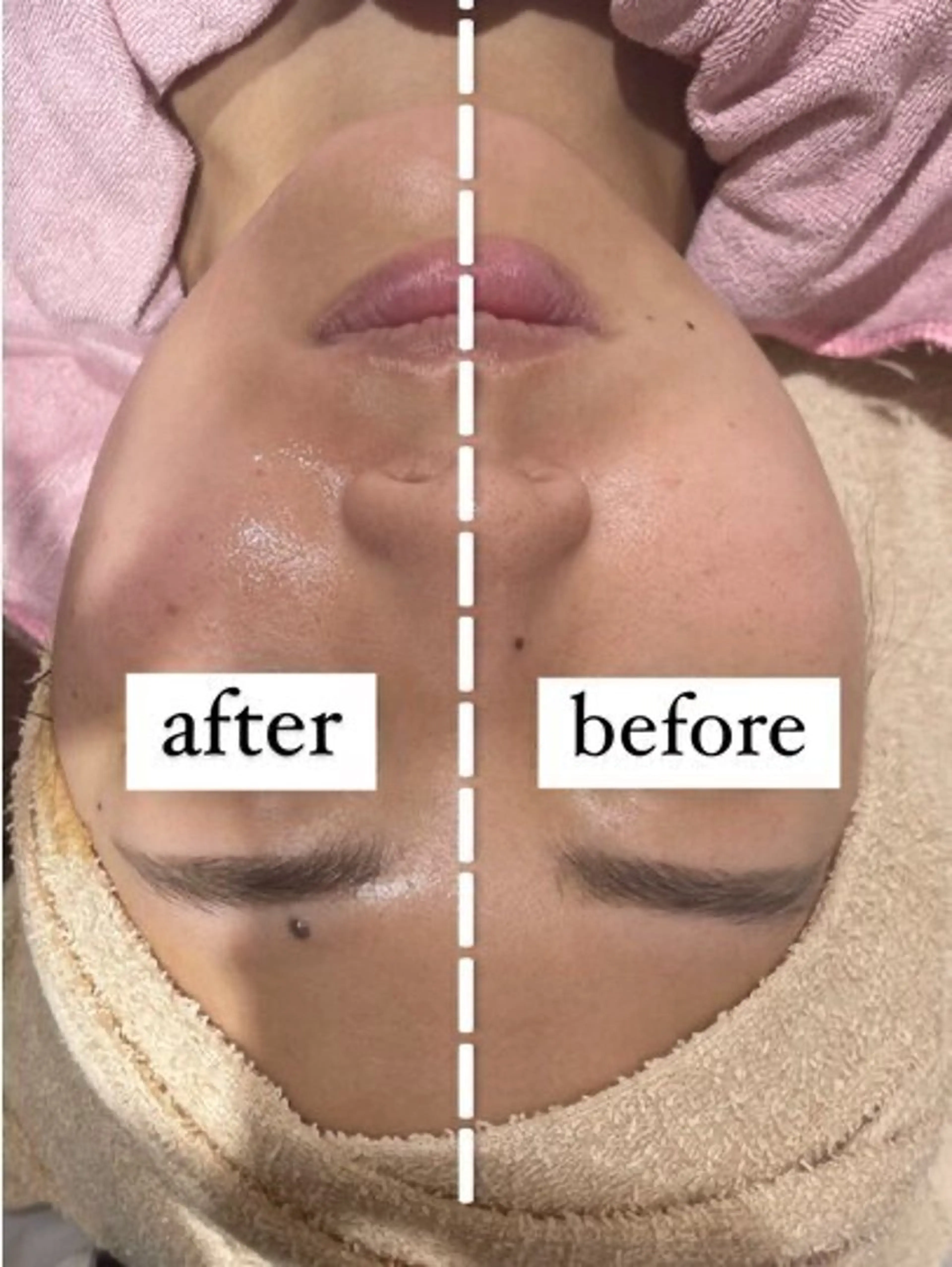 秒速小顔新宿南口 大谷のその他イメージ