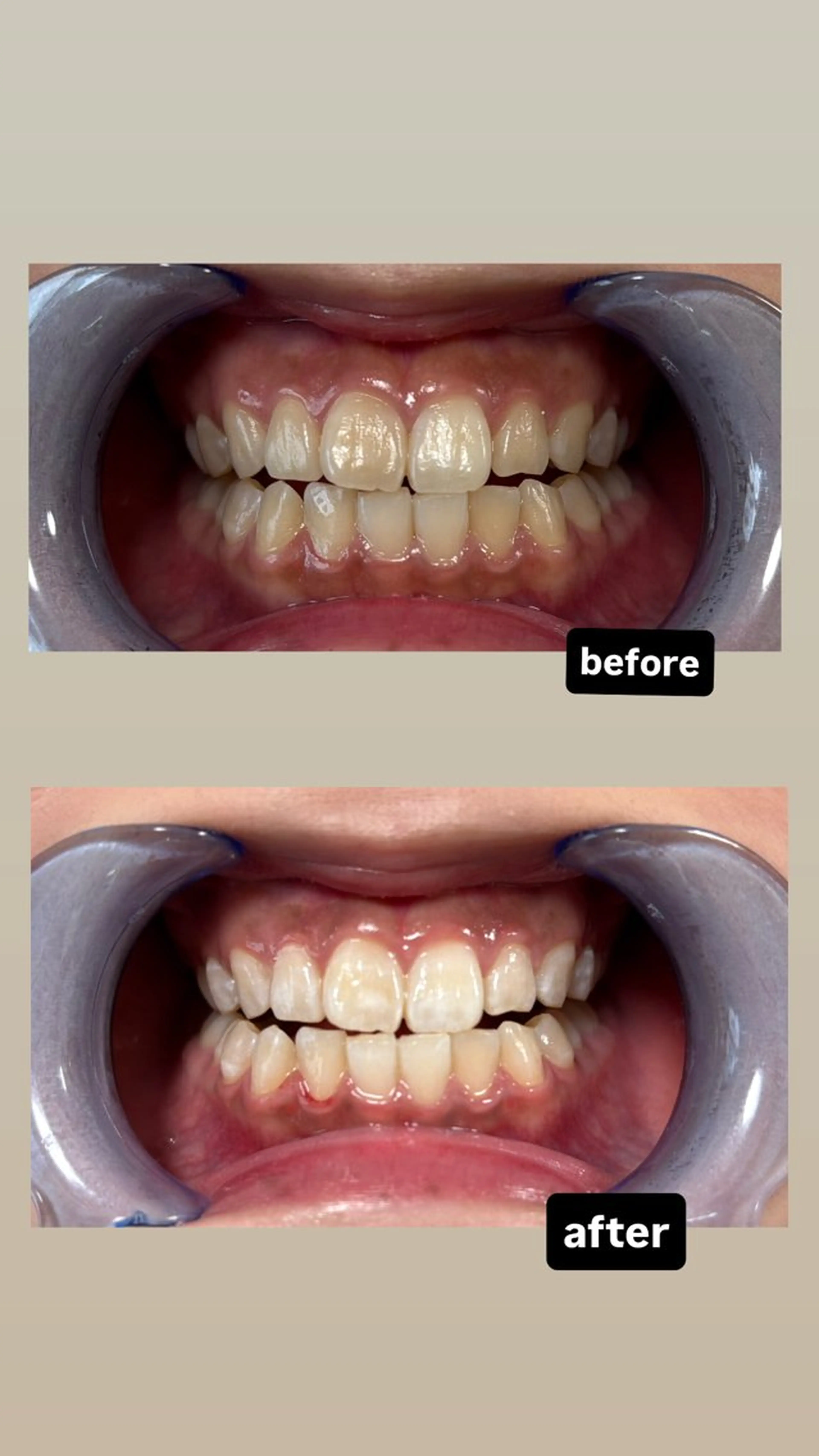 LIBRA 天王寺店所属・セルフホワイトニング リブラ天王寺店のその他イメージ