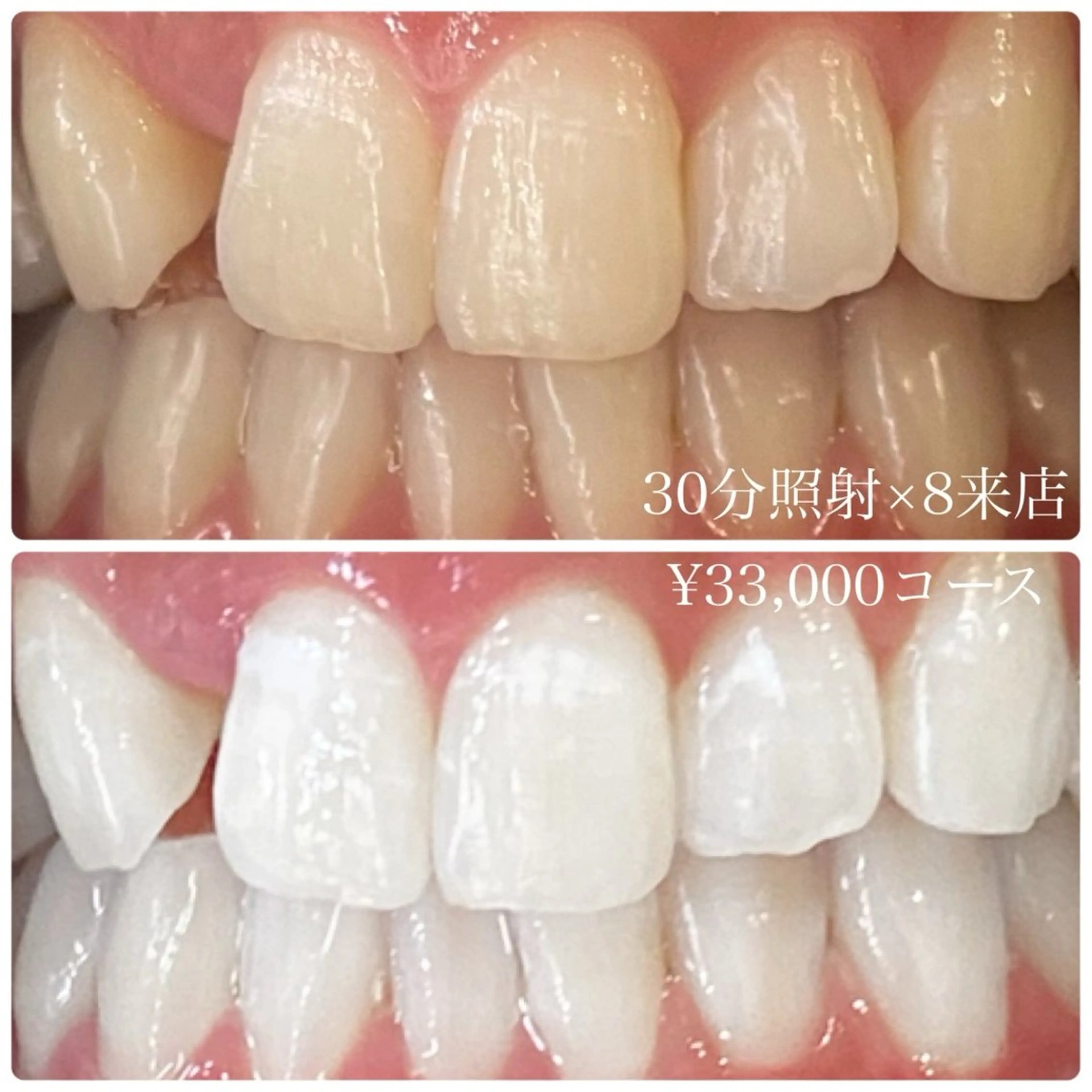 その他 PLATINUM Beauty 横浜店所属・ホワイトニングルーム 横浜店のその他イメージ