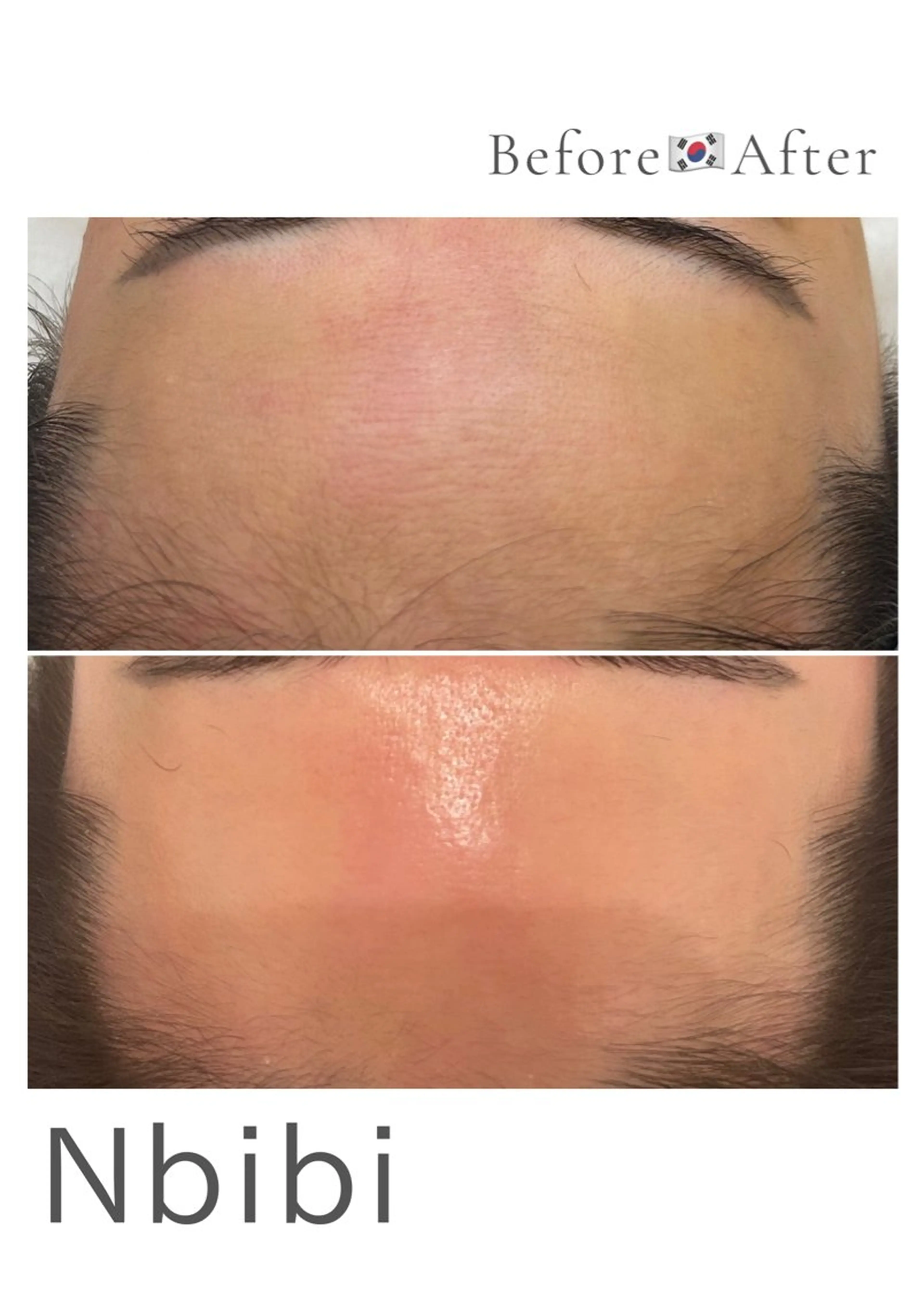 韓国🇰🇷価格 サロン_Nbibiのエステ・リラクイメージ