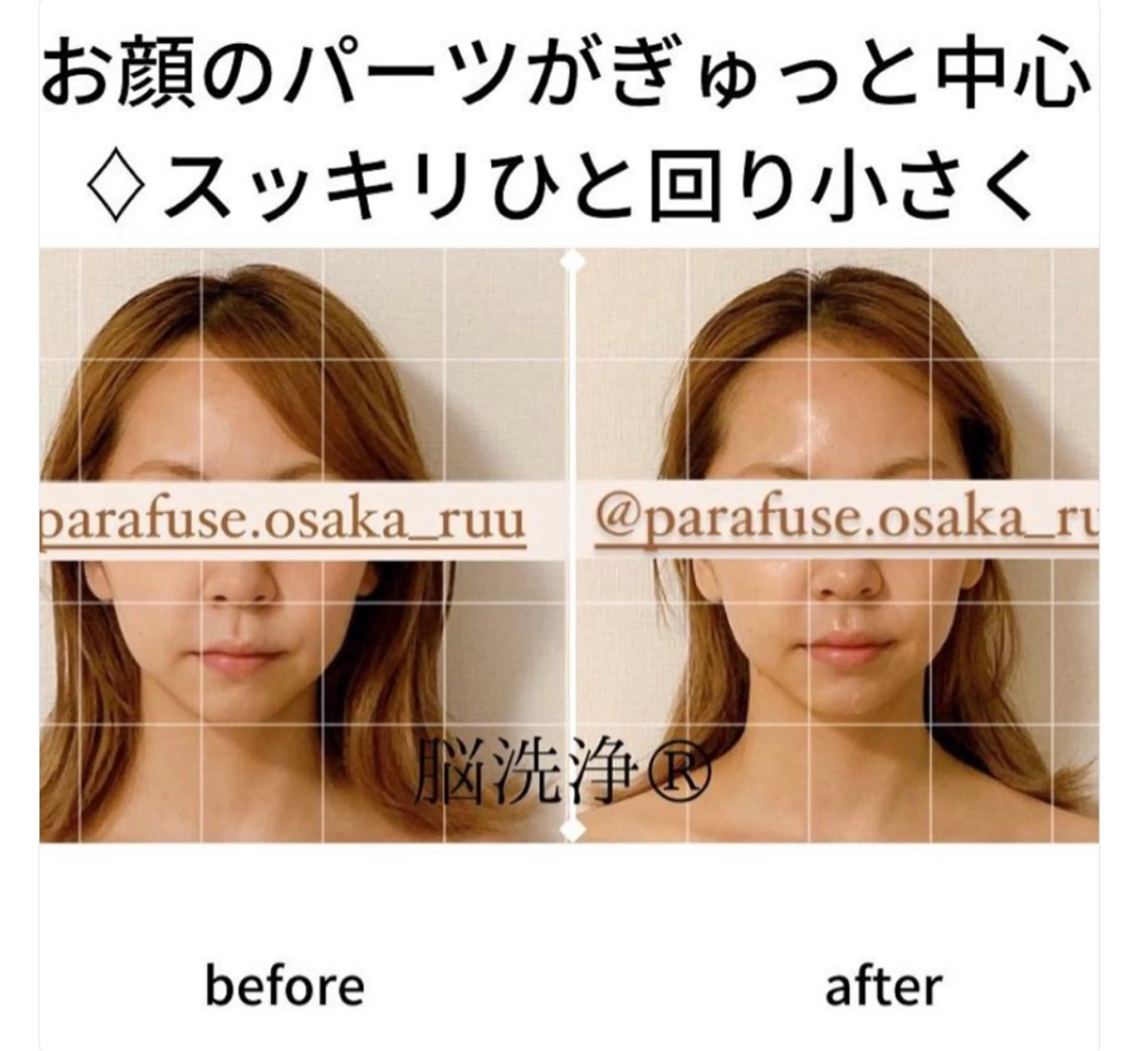 【頭痛、睡眠改善】 salon RUUのエステ・リラクイメージ