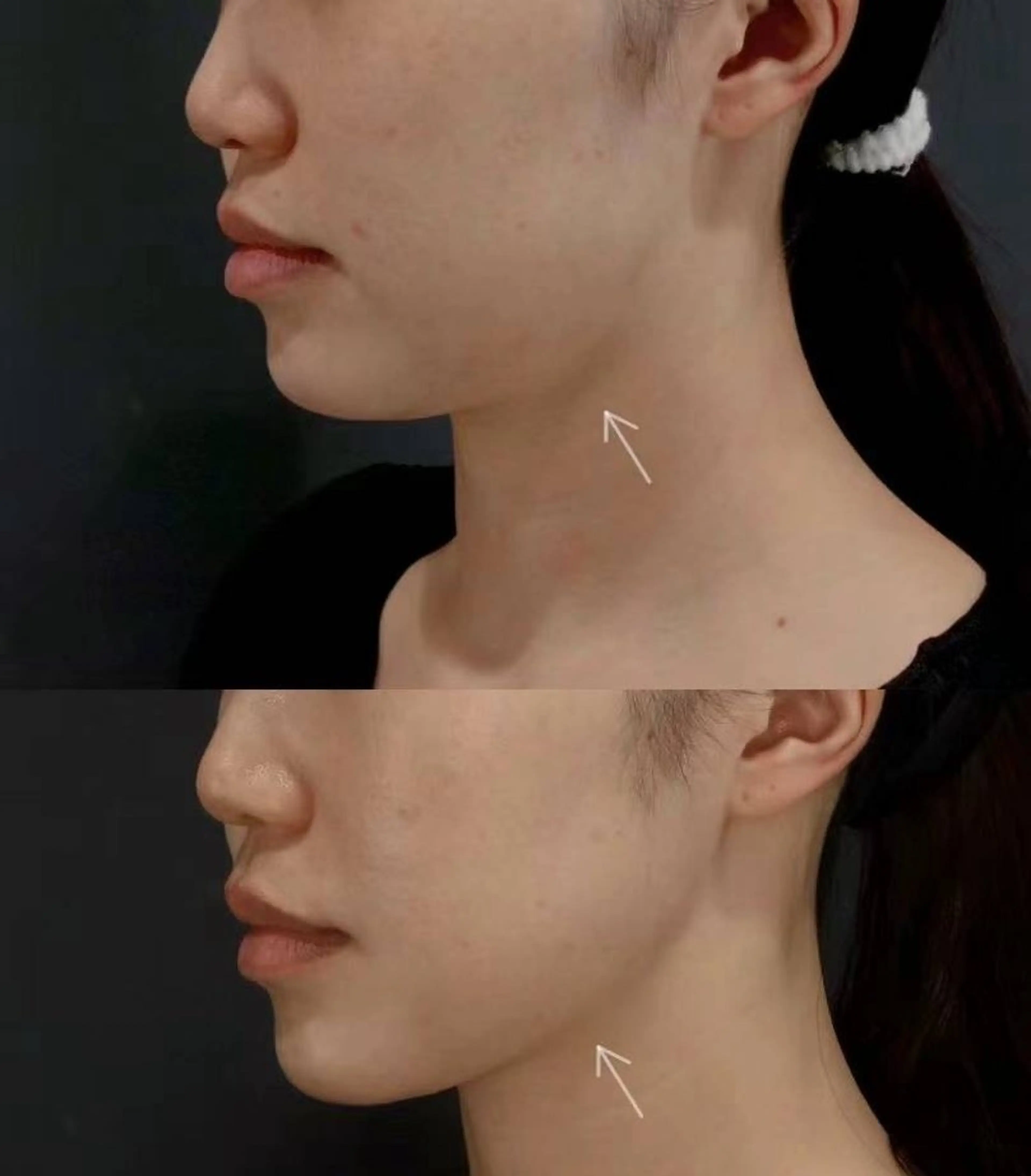 ネイル ブライダルネイル ホワイト aliaハイフ&水光ジェットサロン所属・aliaハーブ水光店 エステティシャン募集のエステ・リラクイメージ