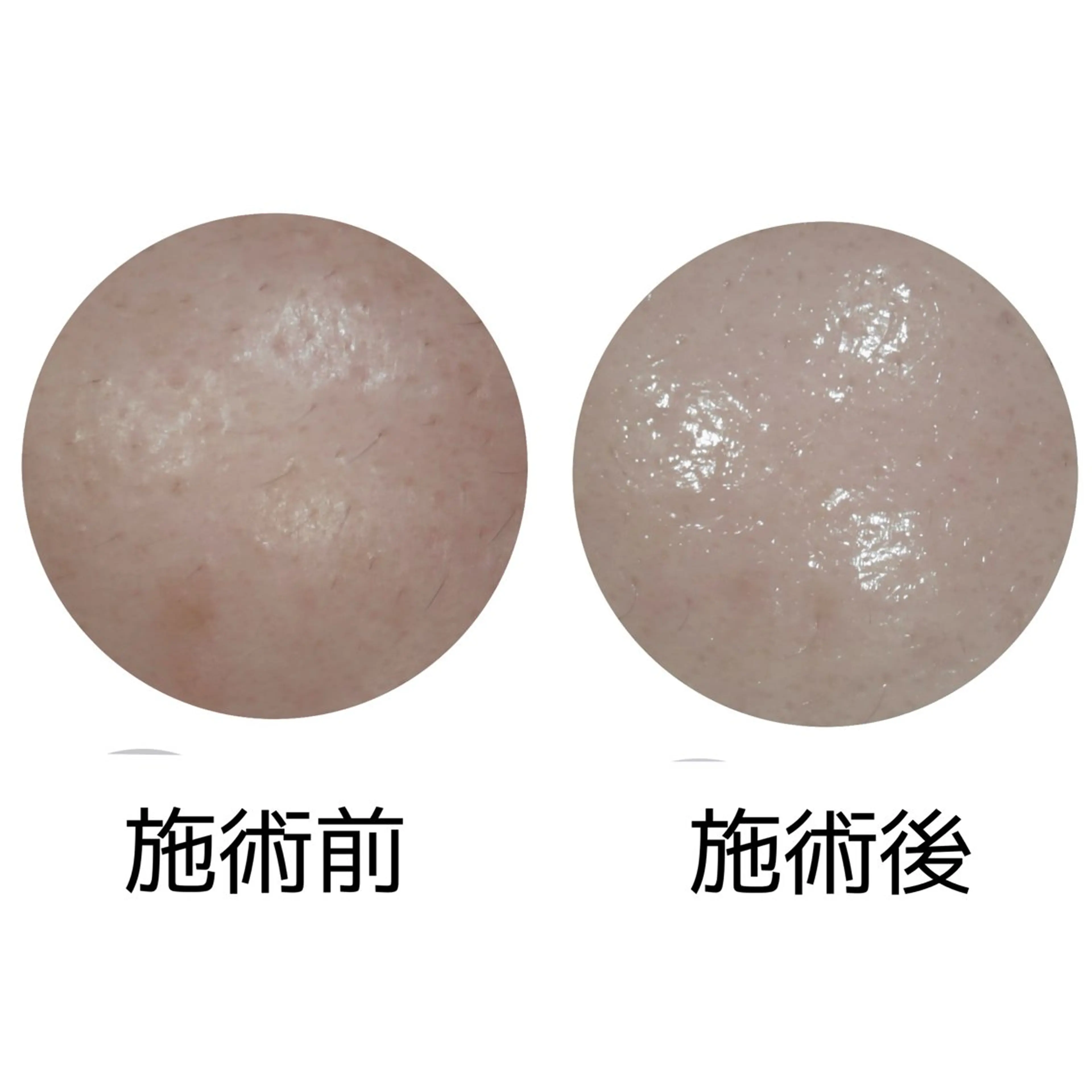 メナードフェイシャルサロン丸の内ヒルズ所属・メナード丸の内ヒルズ 柳田りさのエステ・リラクイメージ