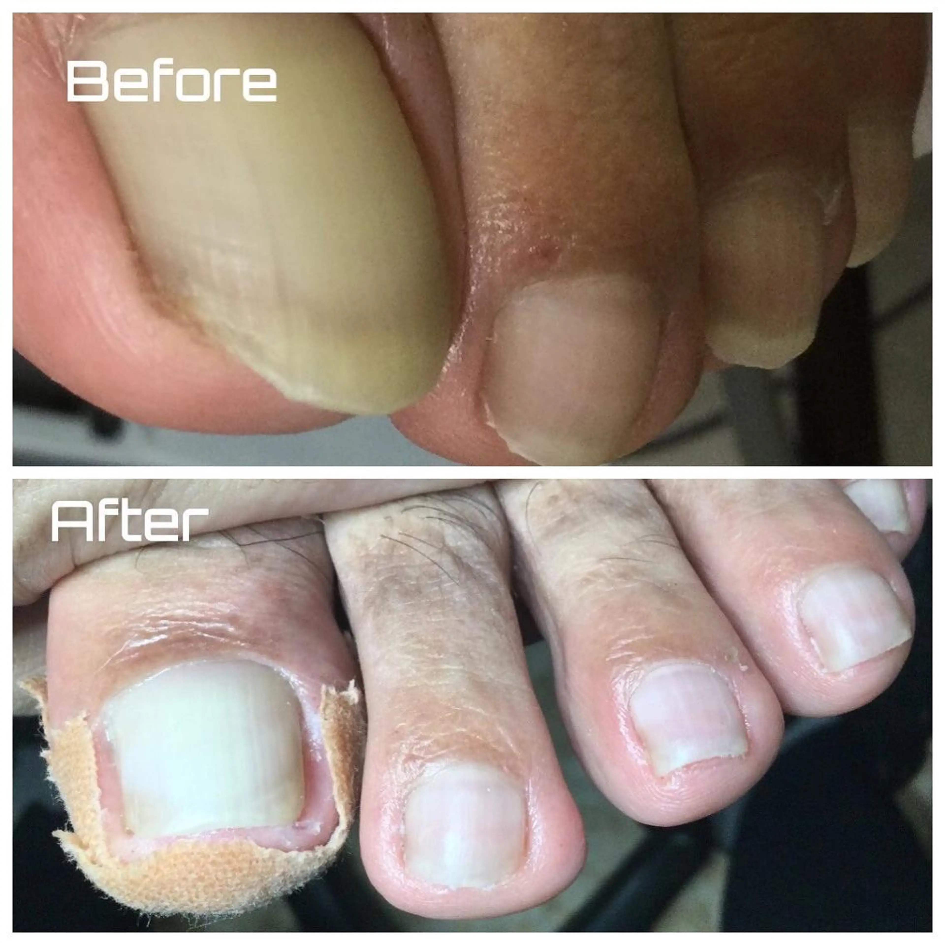 メンズ ネイル ドクターネイル爪革命 takahashiのその他イメージ