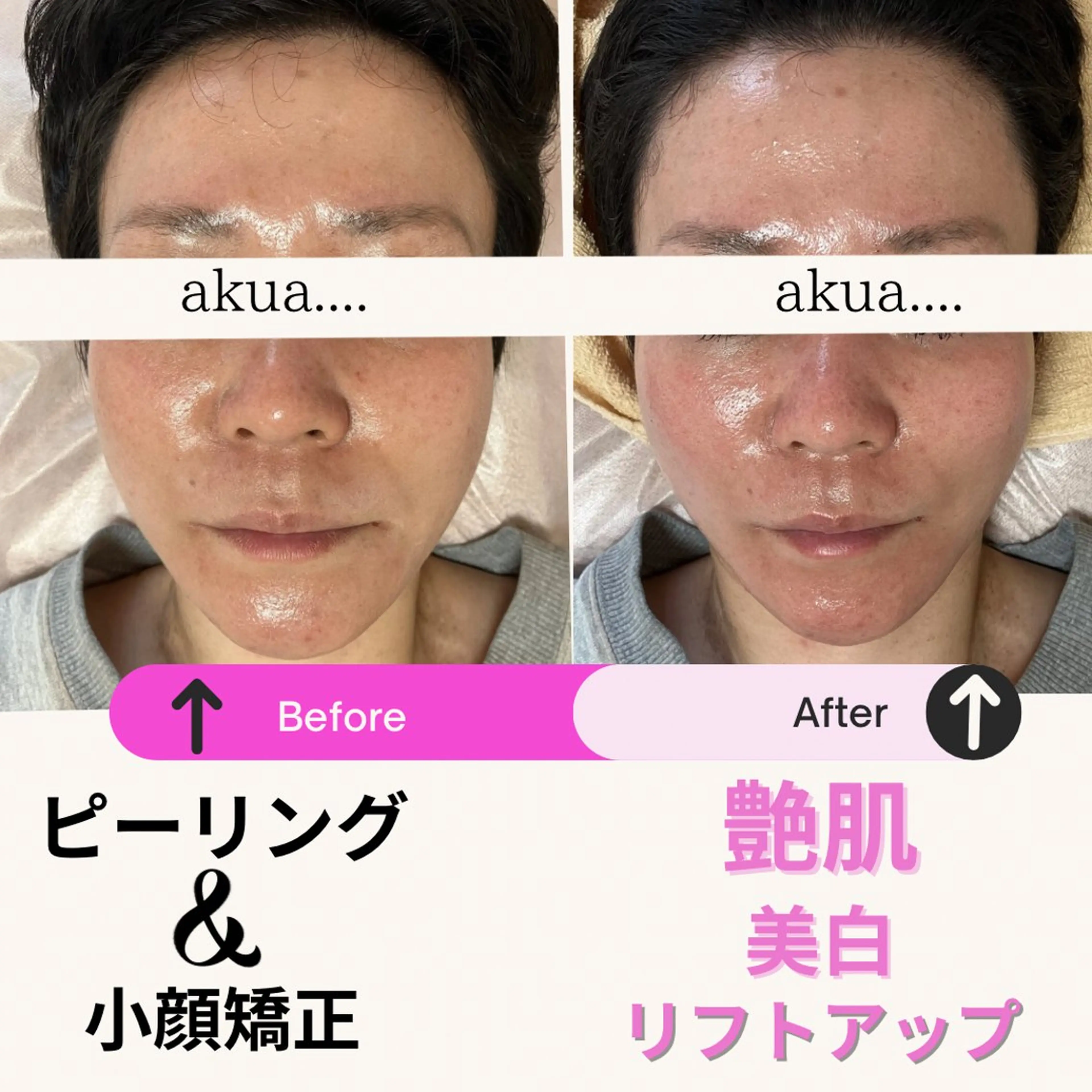 その他 akua... 【肌質管理専門】のその他イメージ