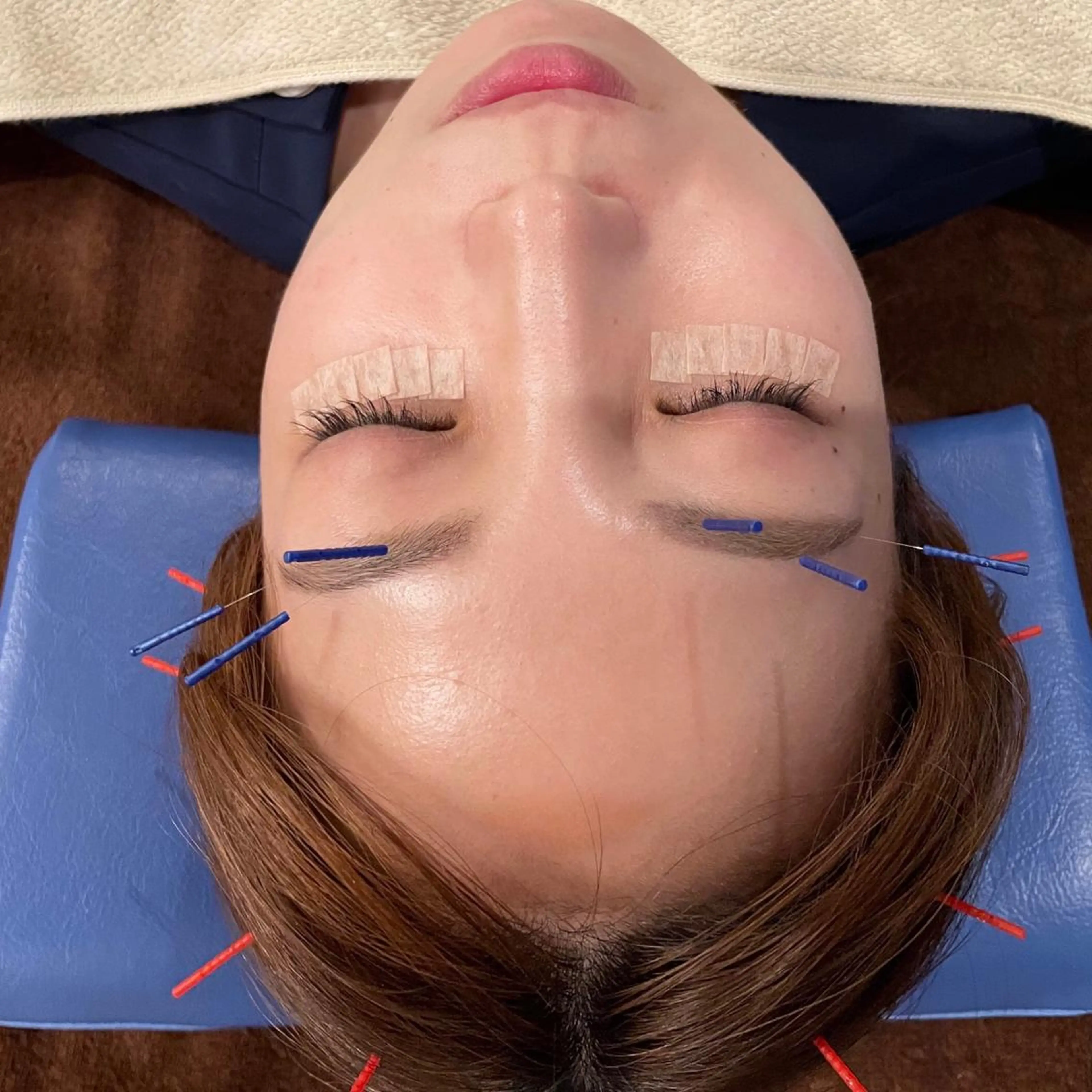 美容鍼　蒼月-aotsuki-所属・美容鍼「蒼月」 -アオツキ-のエステ・リラクイメージ